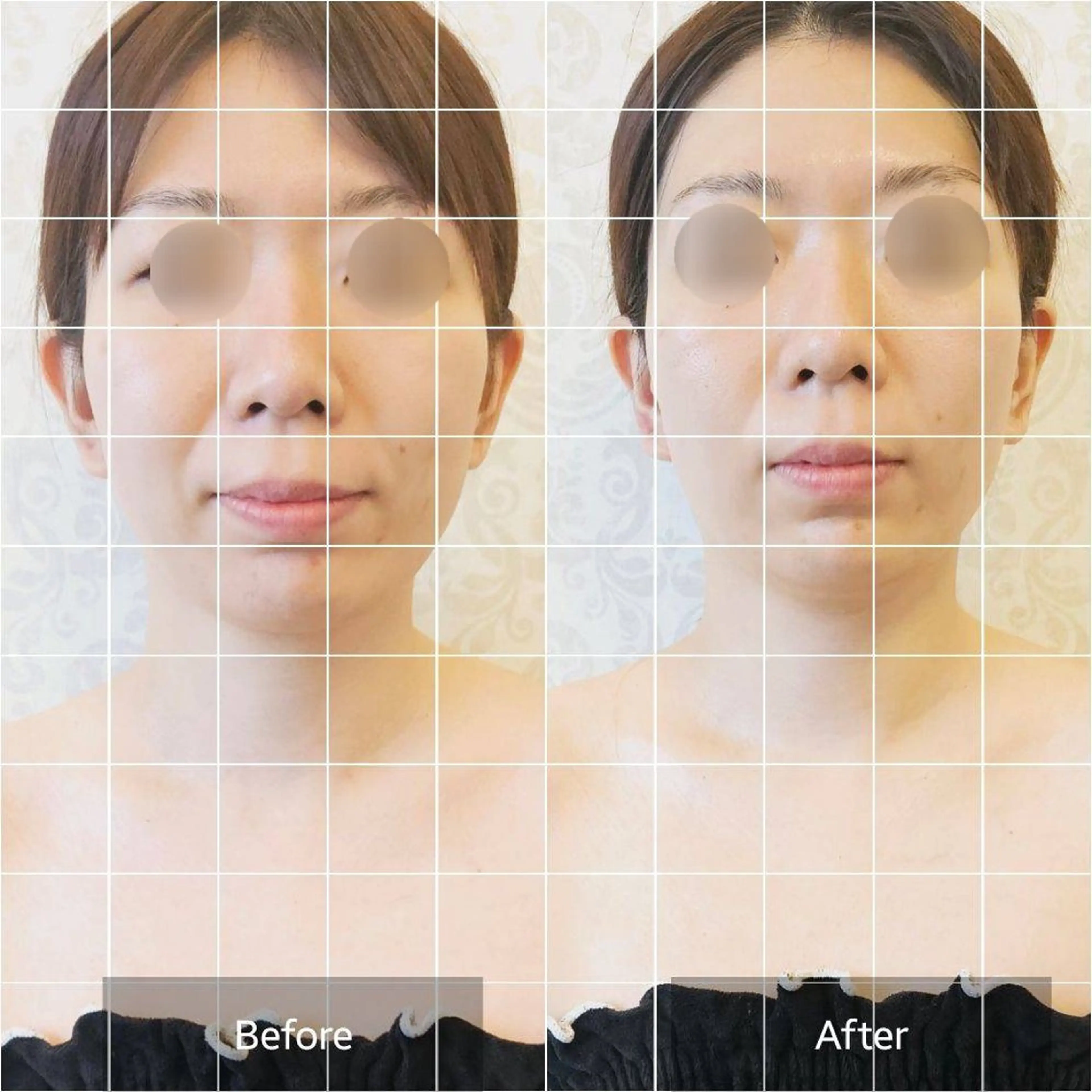 小顔・美肌ケア専門 Diva北浜のエステ・リラクイメージ