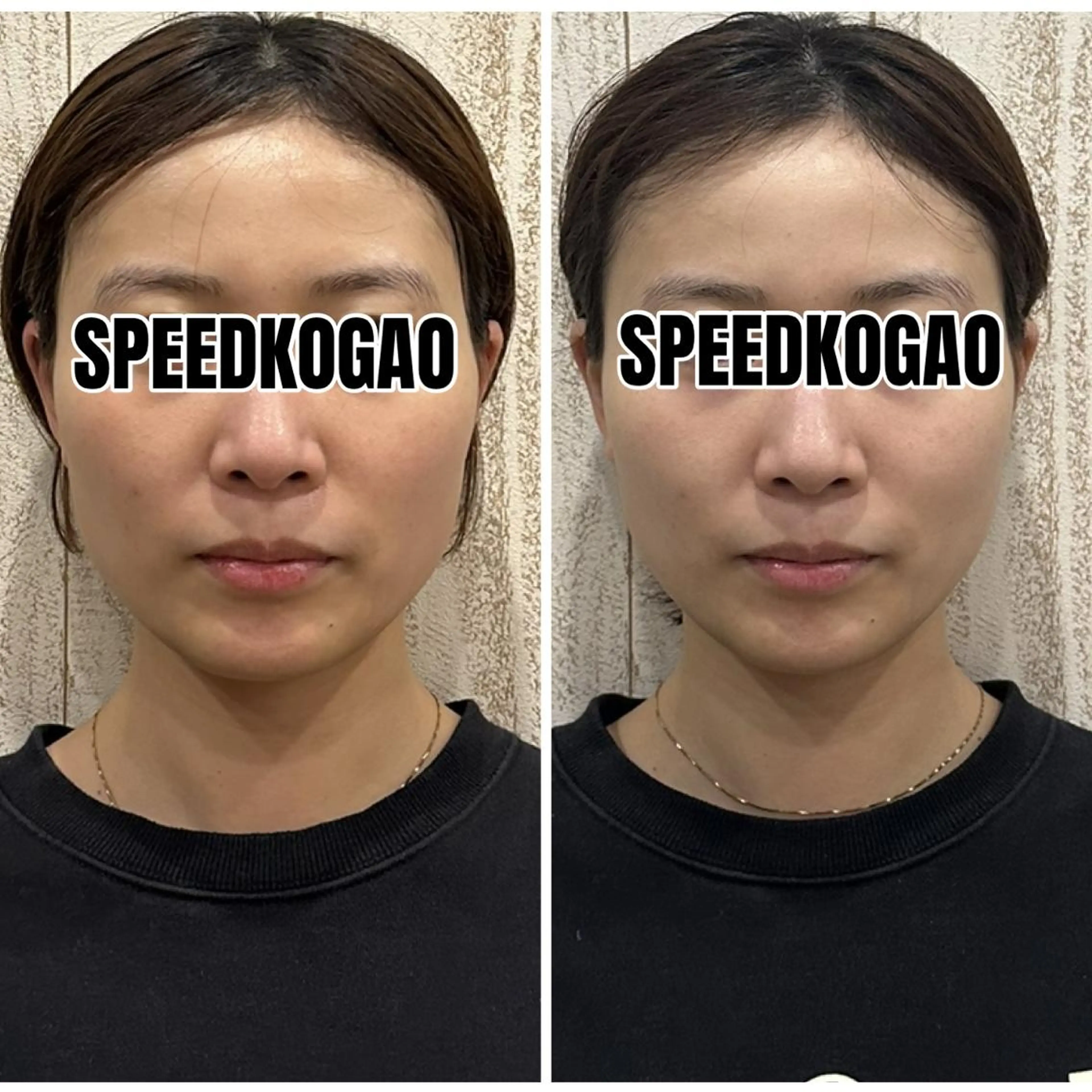 小顔矯正Speed KOGAO渋谷本店のエステ・リラクイメージ