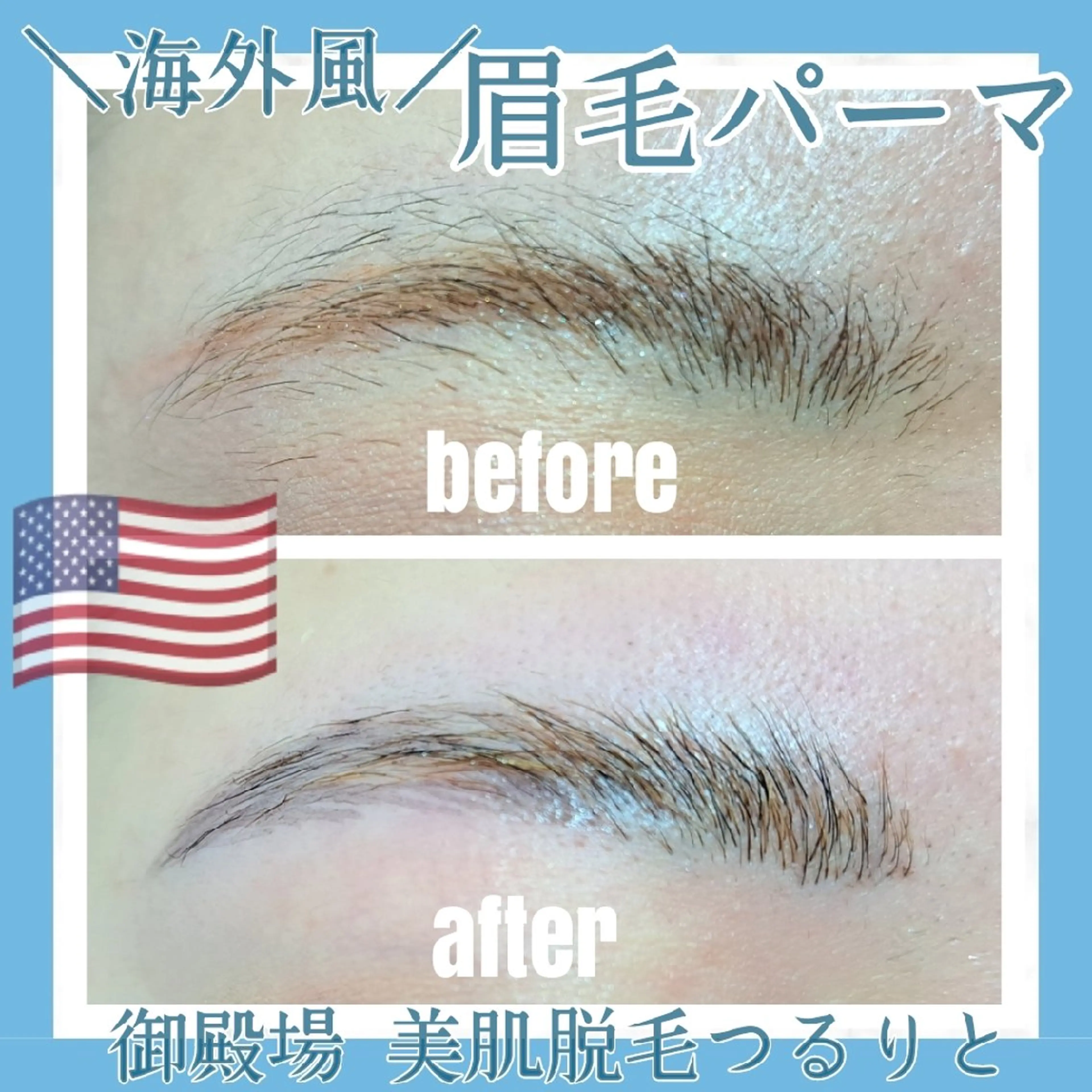 アイブロウ 眉毛ワックス脱毛 美肌脱毛サロン つるりと御殿場店所属・美肌脱毛サロン つるりとのその他イメージ