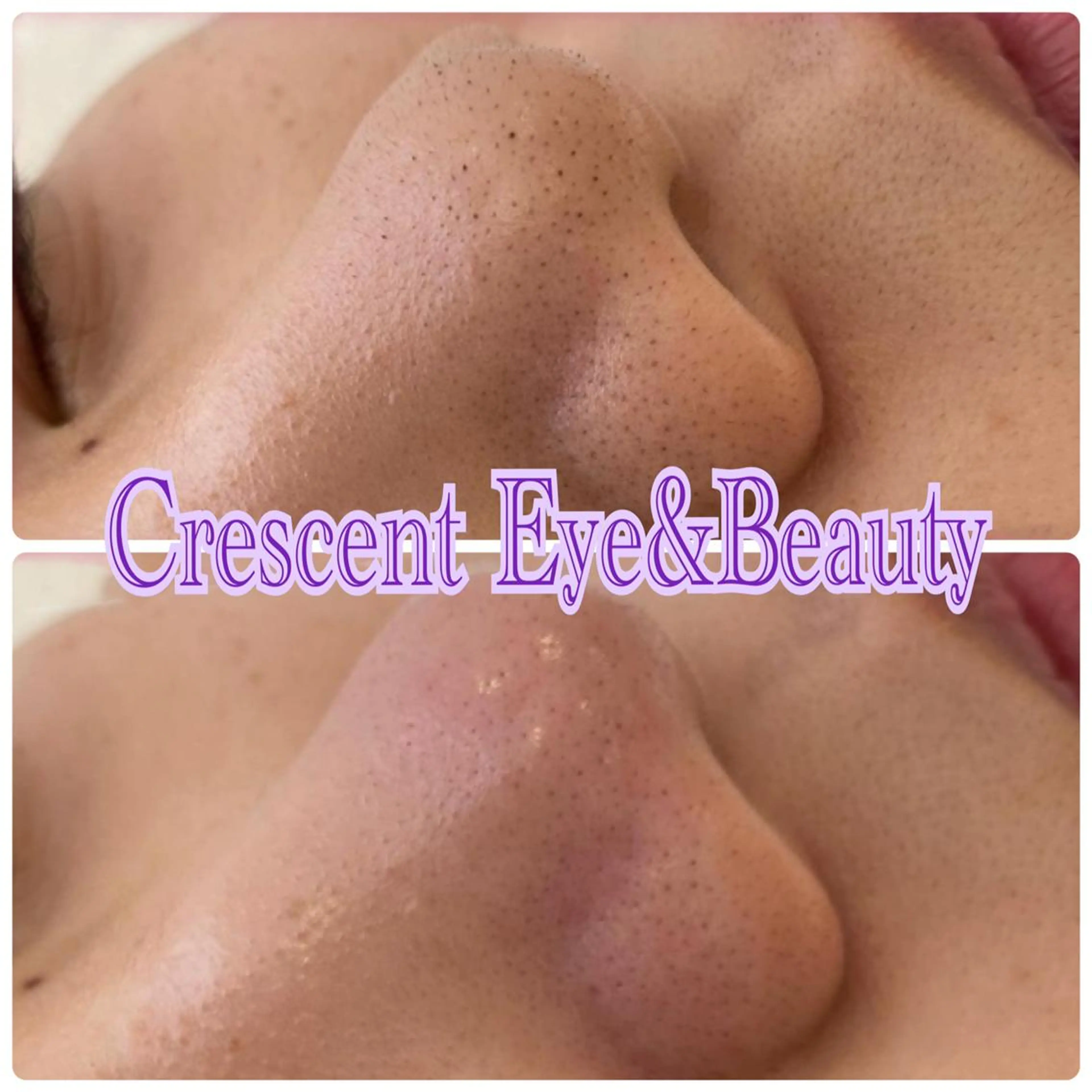 Crescent Beautyのエステ・リラクイメージ