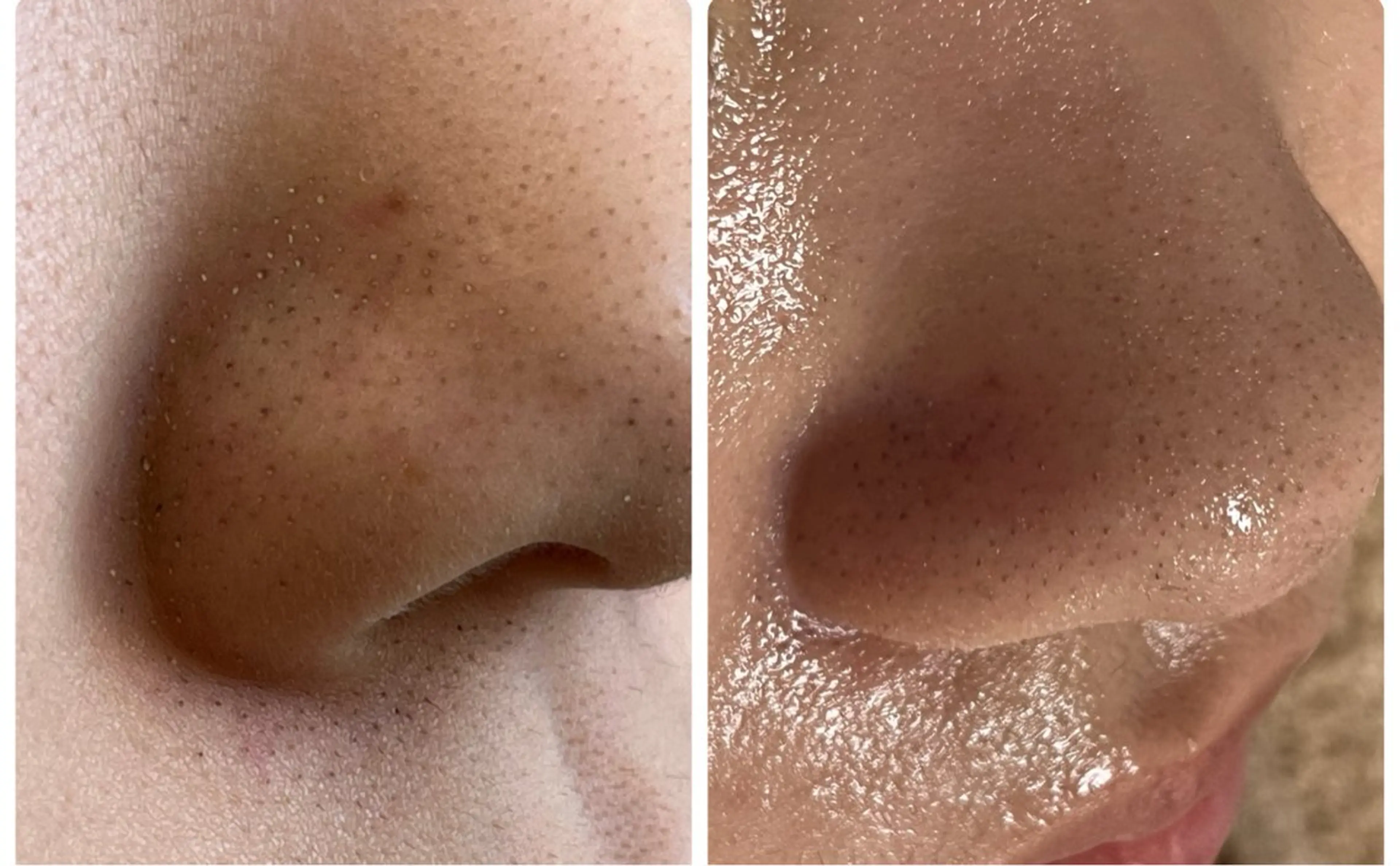 デ・アイム赤城所属・ナリス化粧品🌹 saoriのエステ・リラクイメージ