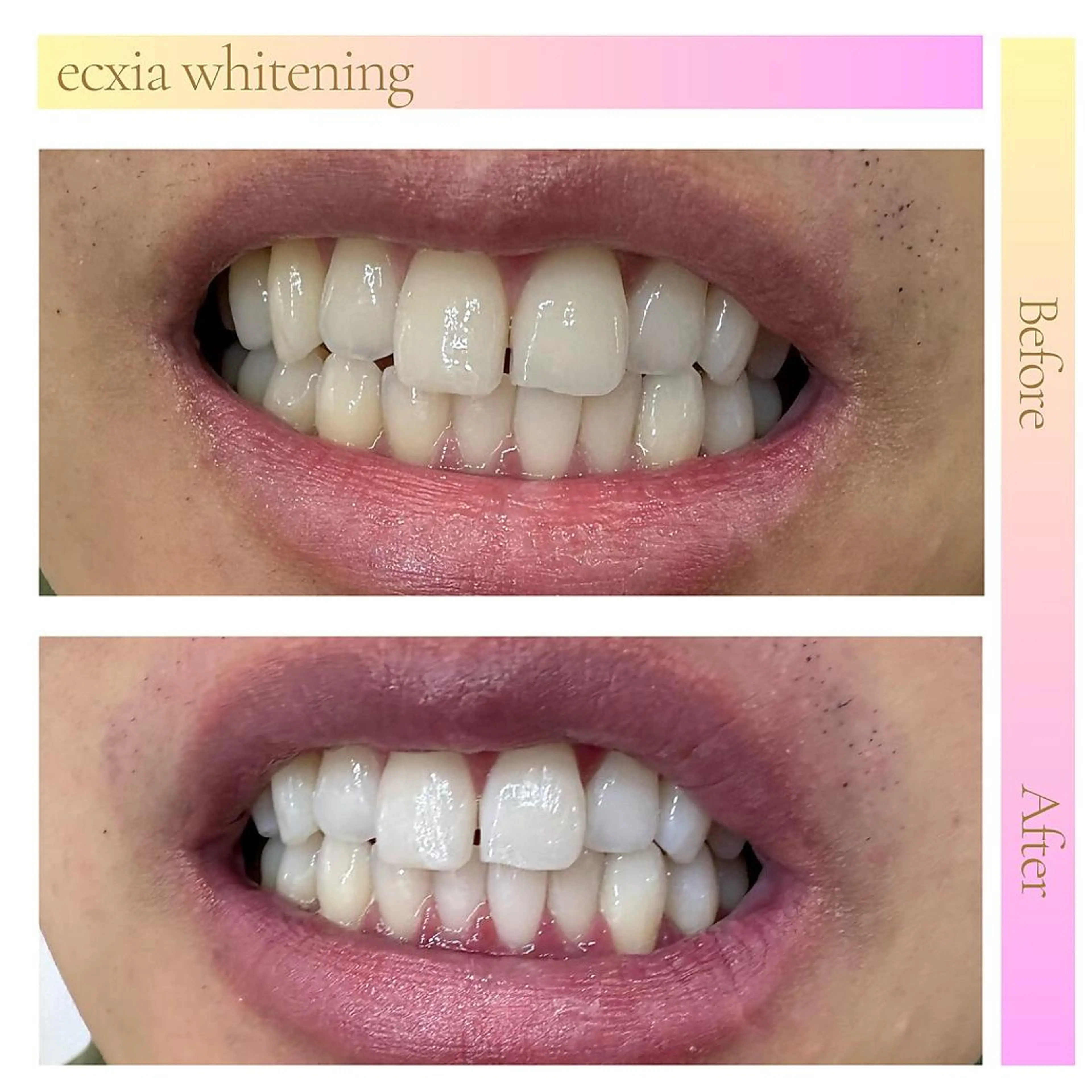 エクシアホワイト 北千住店のその他イメージ