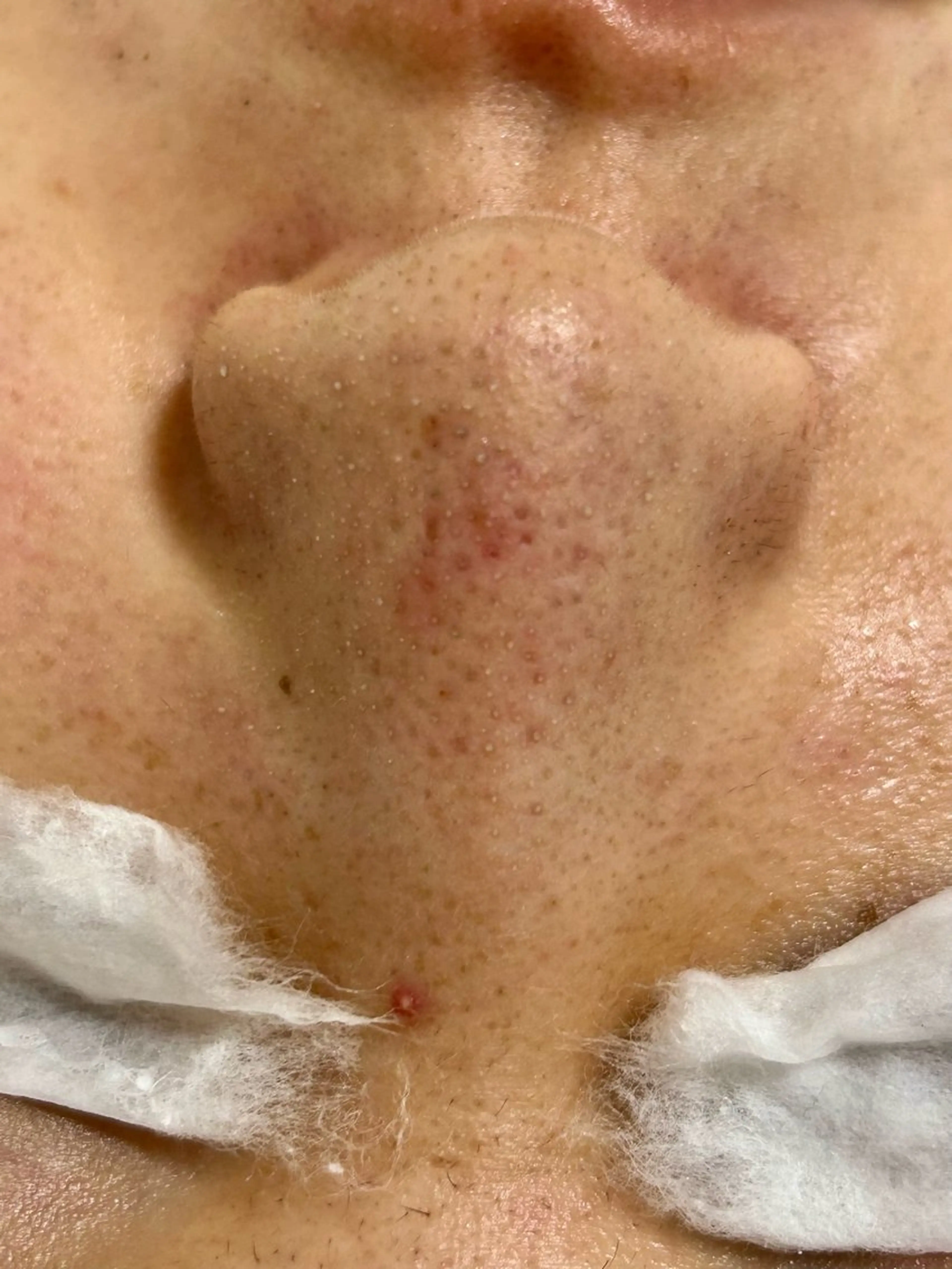 その他 麻布十番エステサロン WhiteAzabuのエステ・リラクイメージ