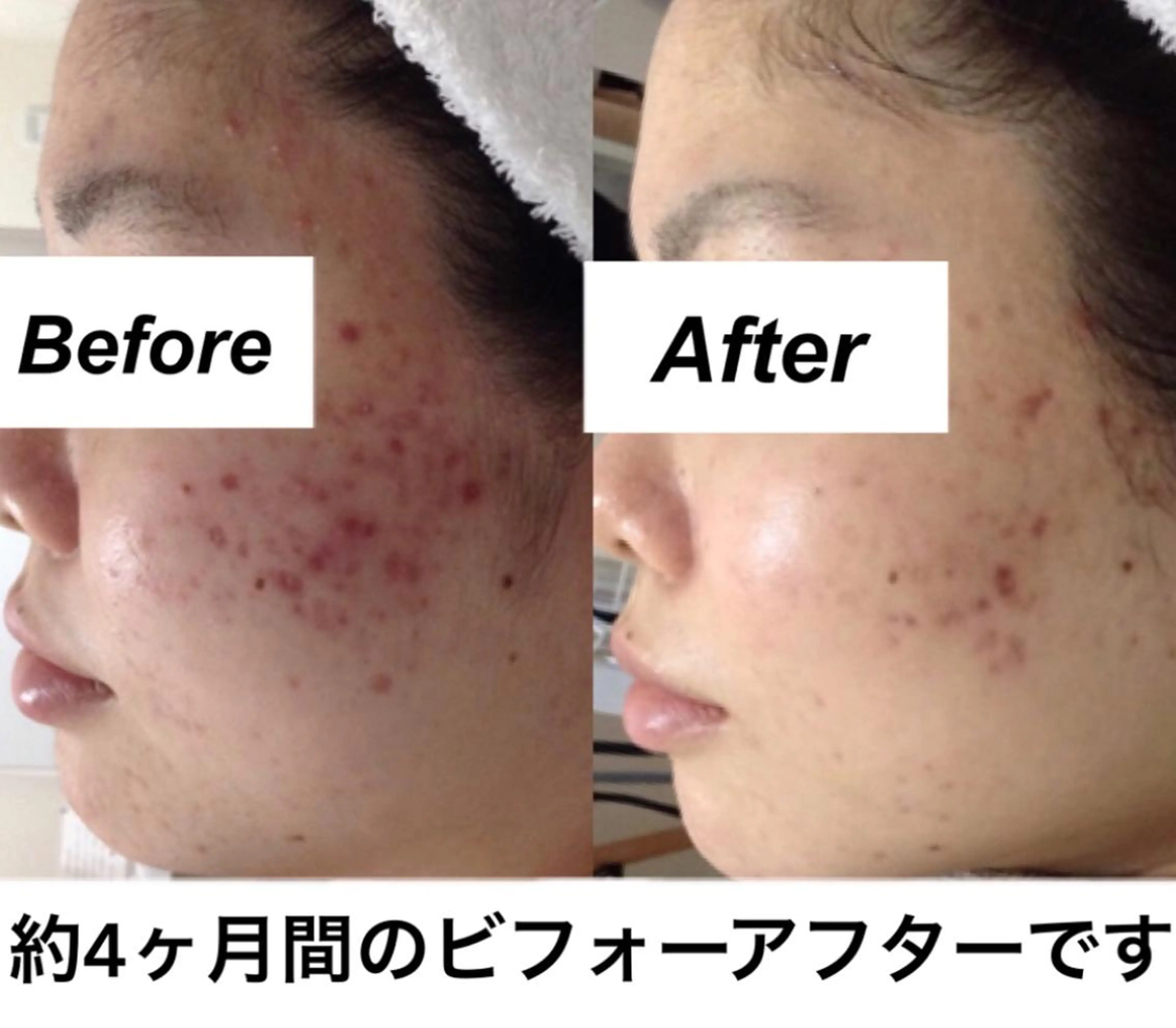 エステ リラク 都度払い肌質改善 &脱毛Blancheのエステ・リラクイメージ