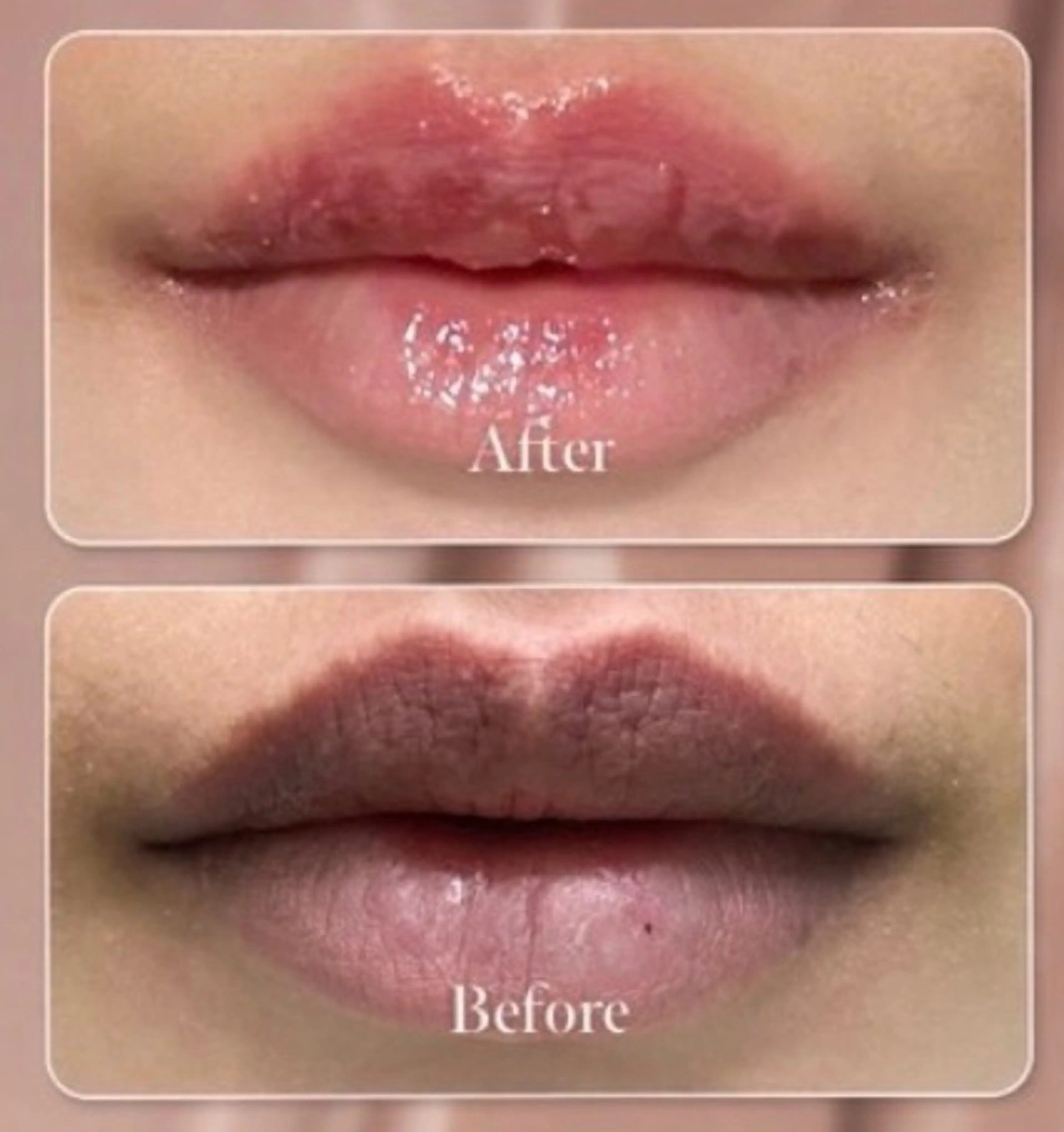 その他 MiMi所属・ヘアセット/ネイル/ メラニンケア/えりかのネイルデザイン