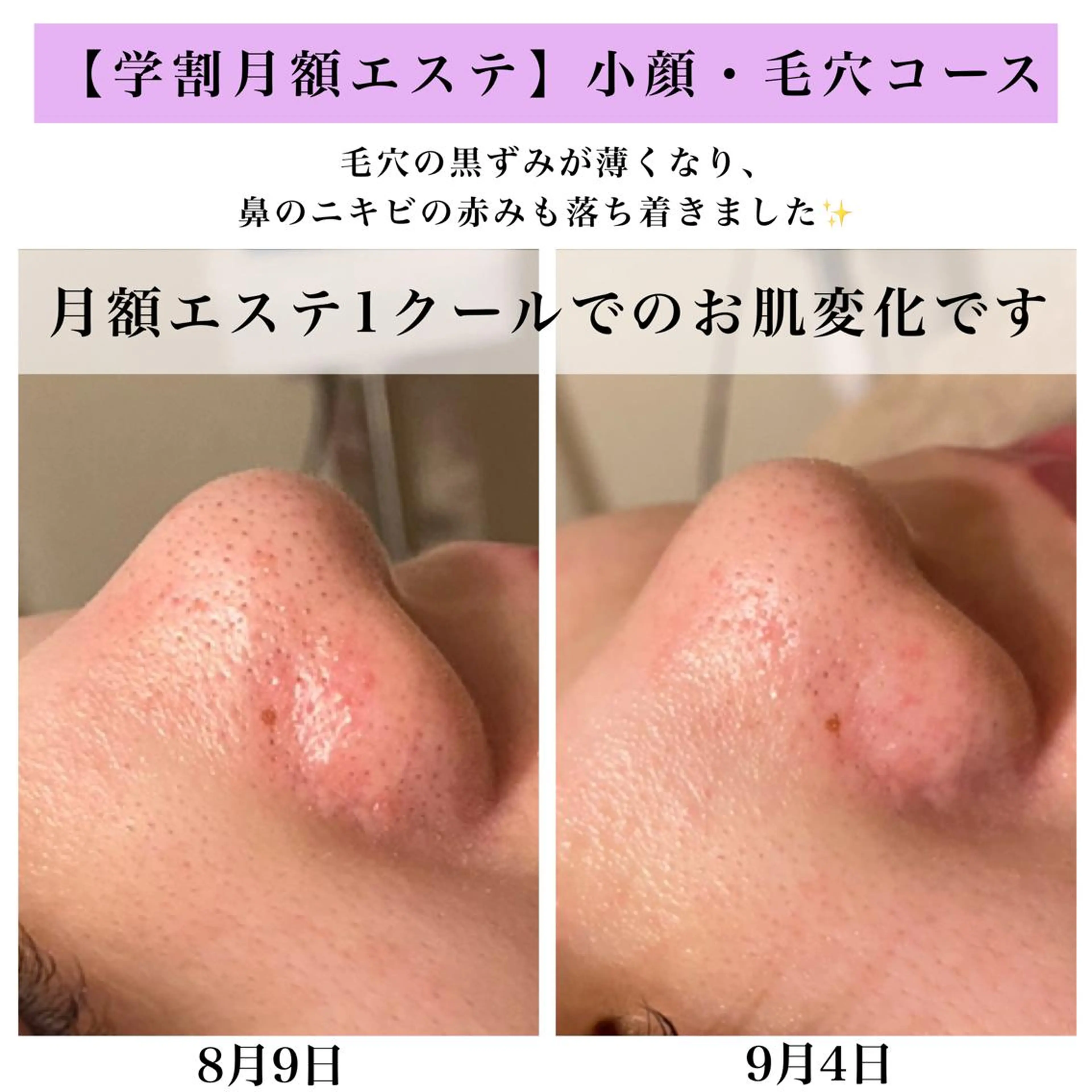 Bellesthe （ベルエステ）のエステ・リラクイメージ