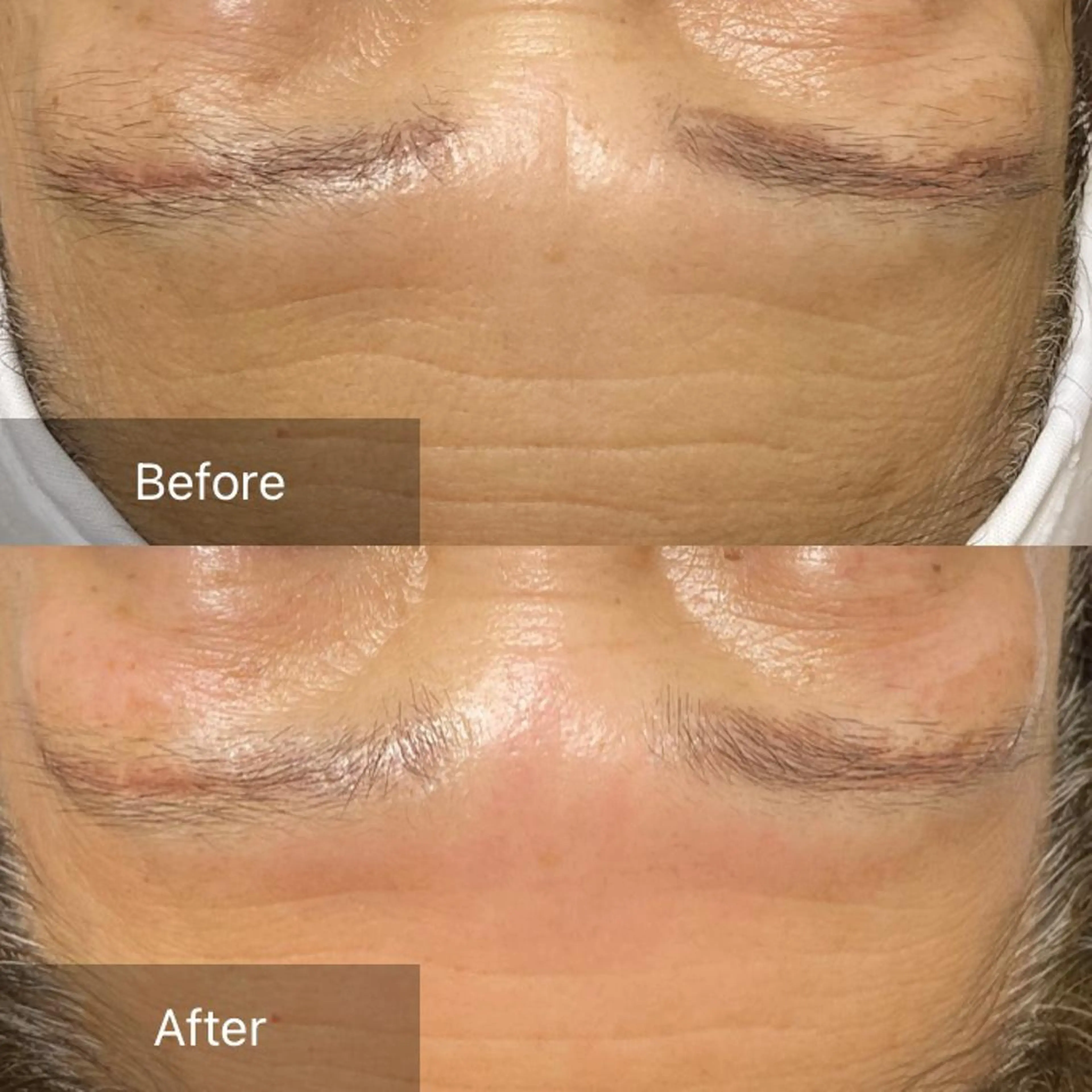 脱毛 産毛専門店 Bittoのエステ・リラクイメージ