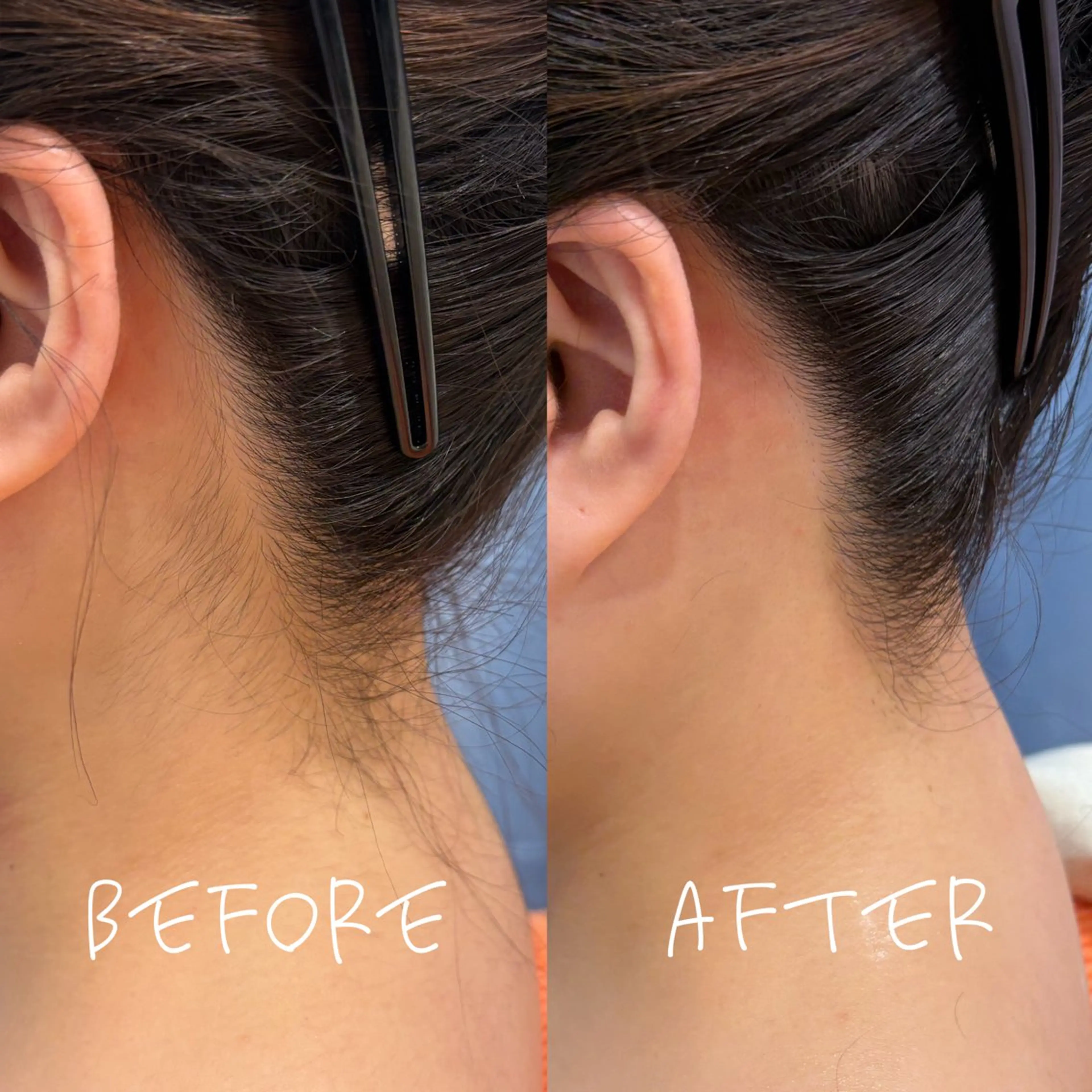 山内 里華のその他イメージ