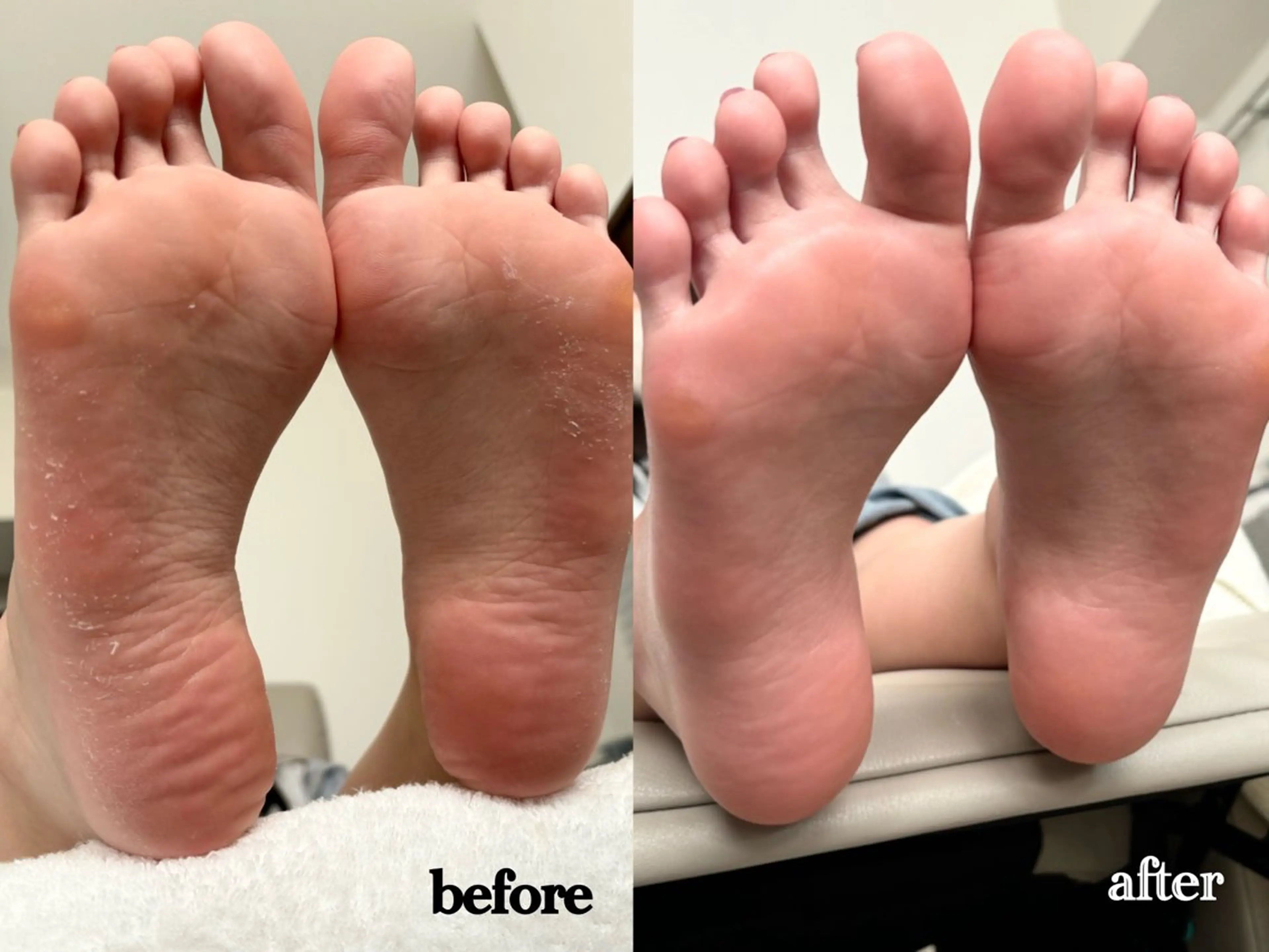 【極上👣しっとりツルすべ足裏角質ケア】※足湯＆パラフィンパック付きの写真