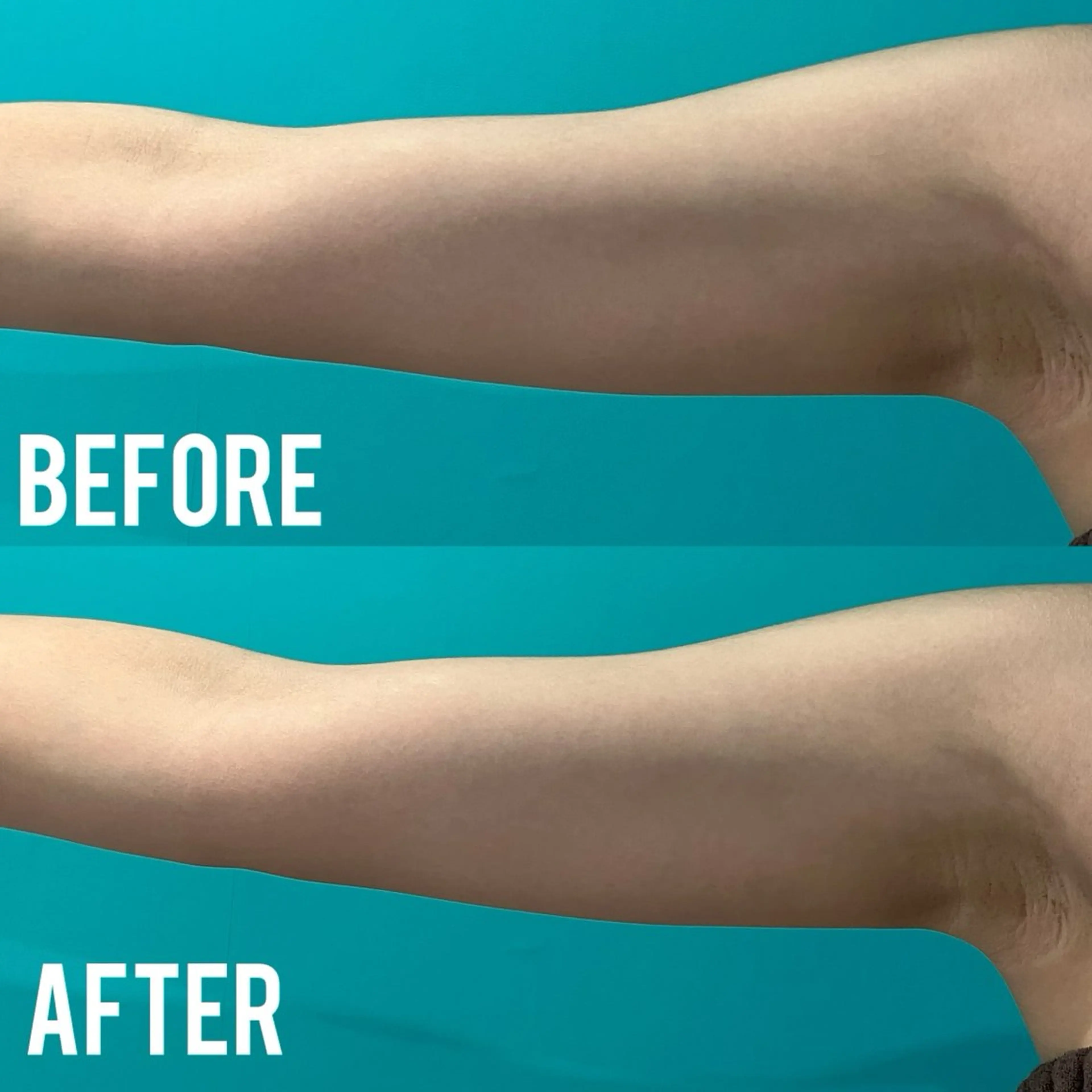 1度で実感‼️リンパ流し！最新マシン部分痩身モデルの写真