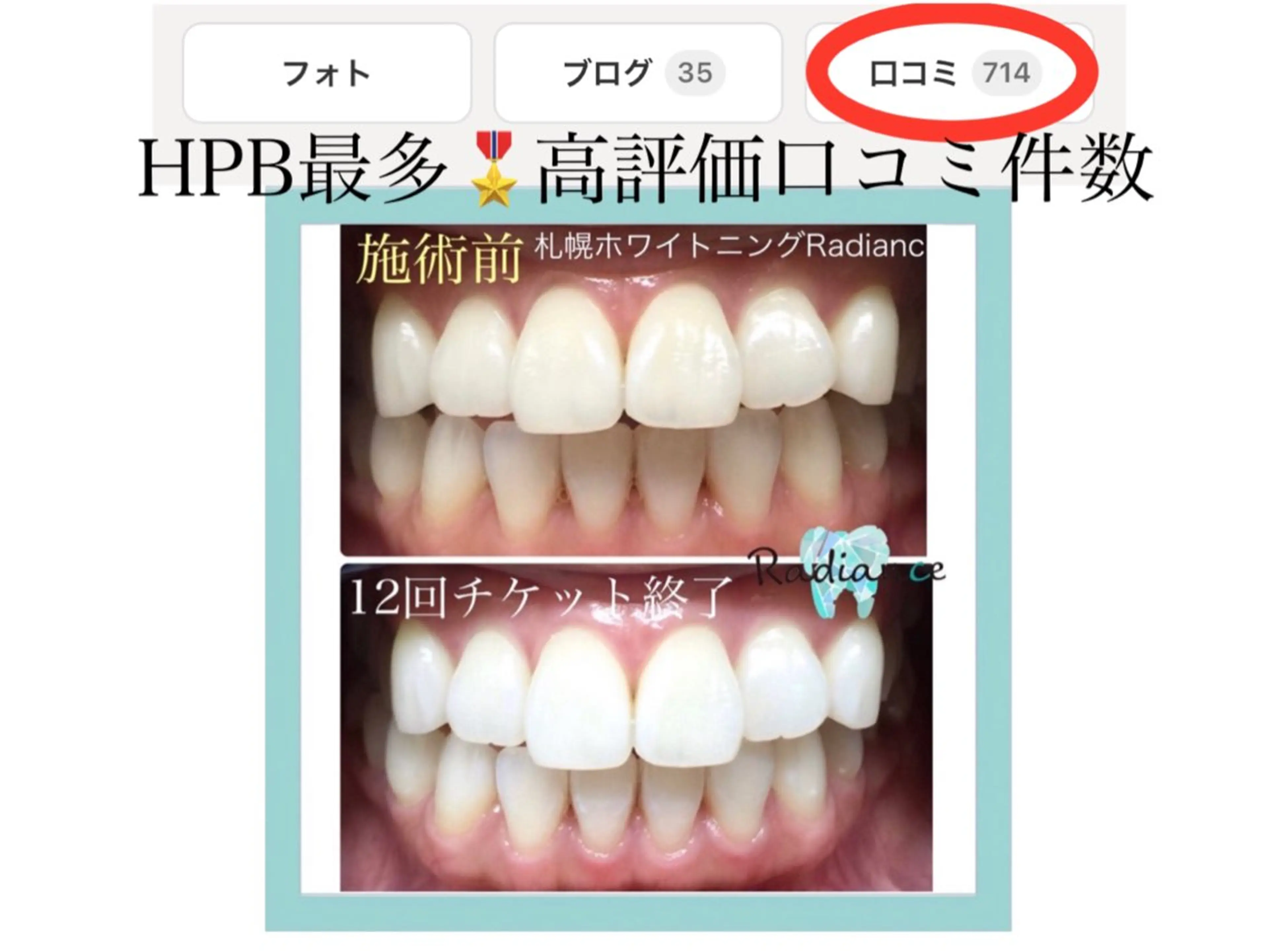 その他 札幌ホワイトニング ラディアンス札幌駅店のその他イメージ