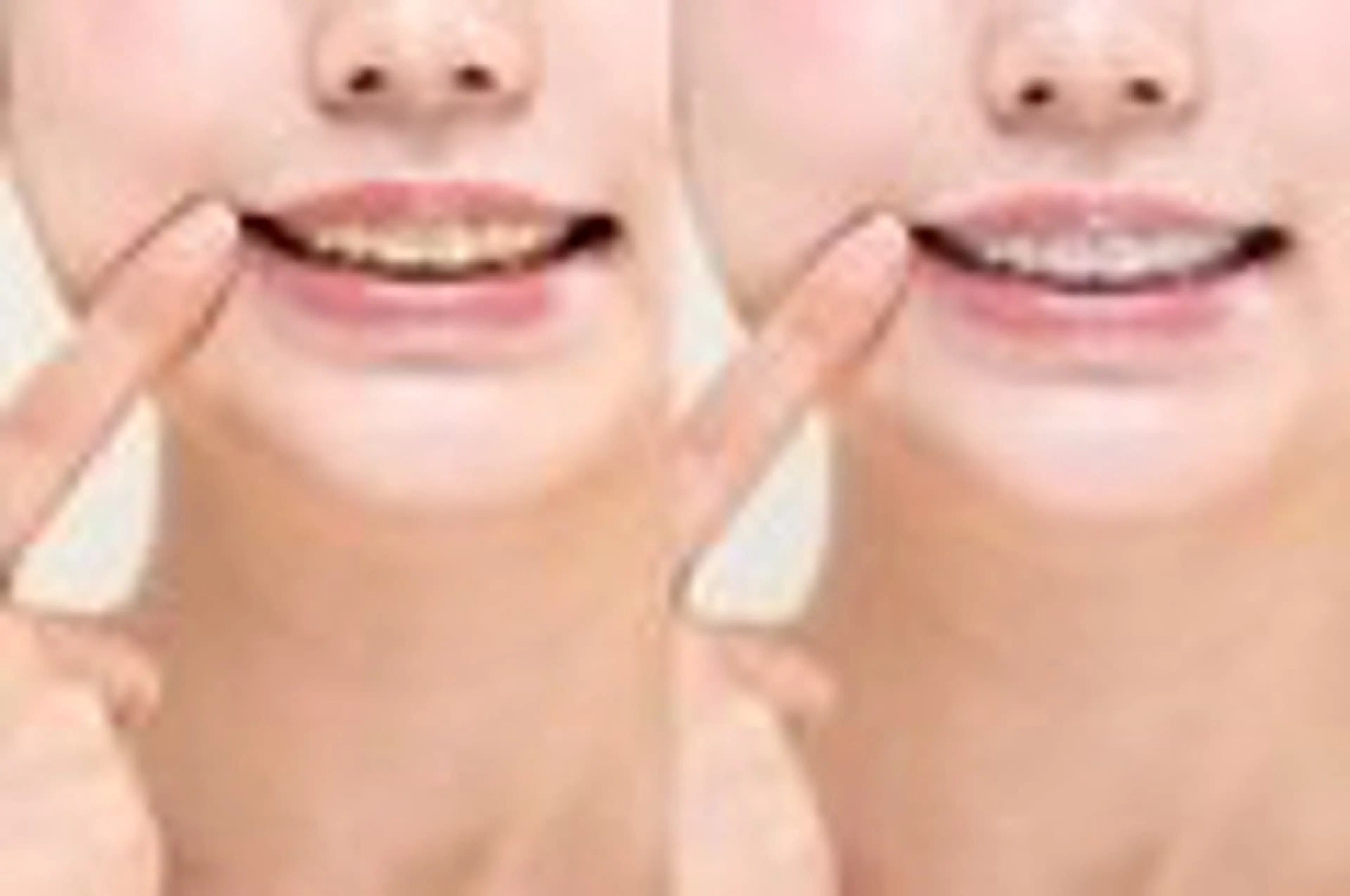 ecxia white 高田馬場所属・セルフホワイトニング エクシア 高田馬場のその他イメージ