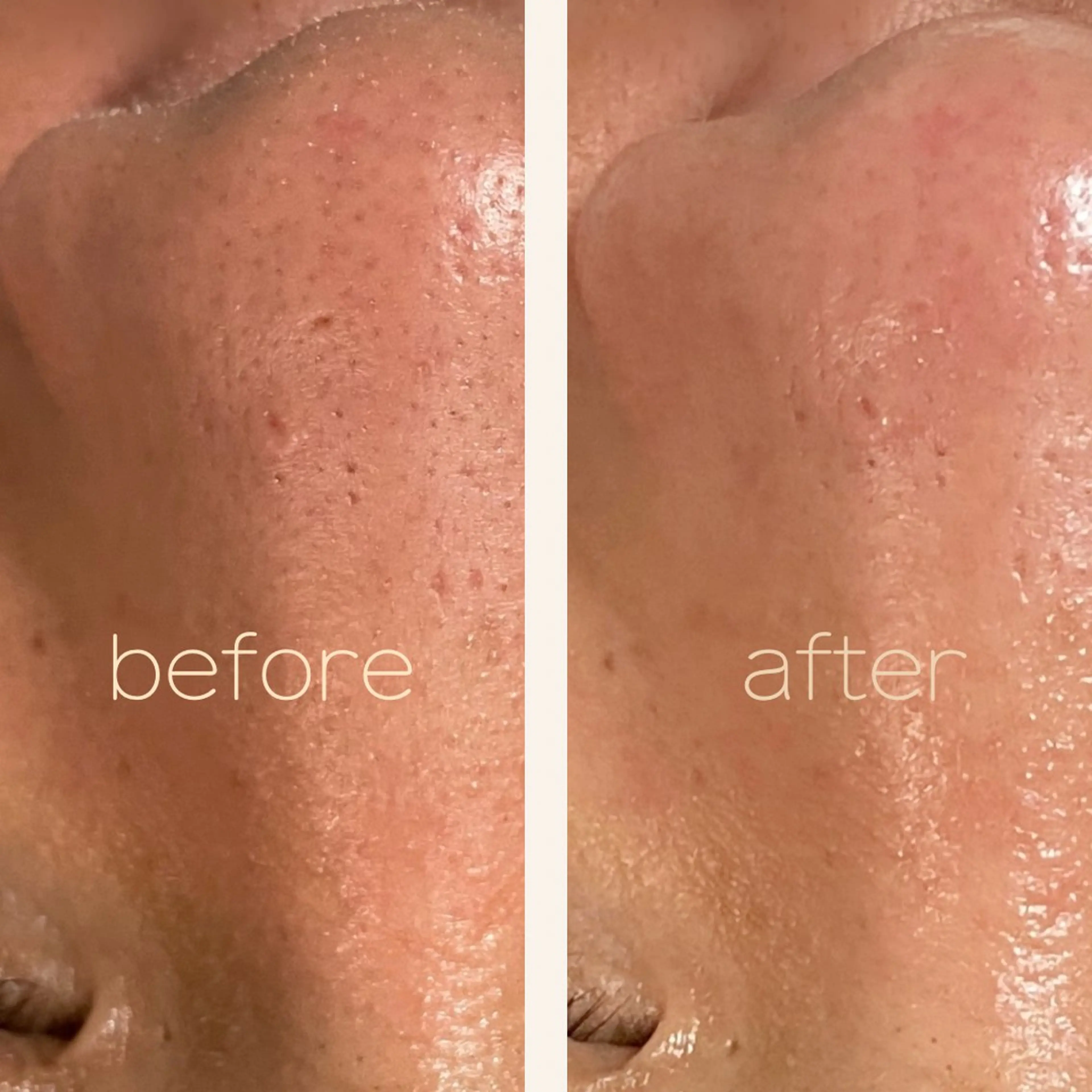 エステ リラク Luce所属・Luce Shokoのエステ・リラクイメージ