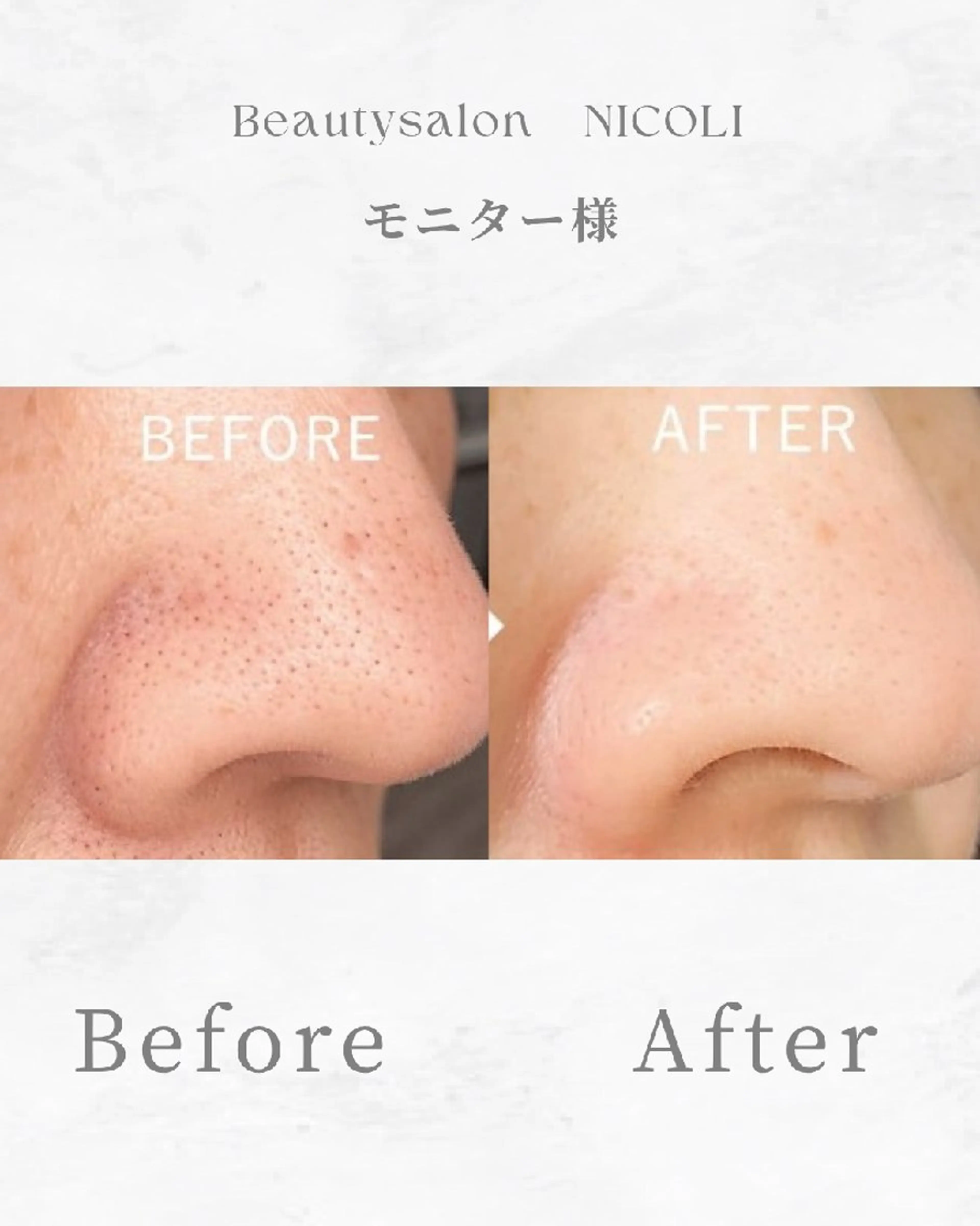 エステサロン NICOLIのエステ・リラクイメージ