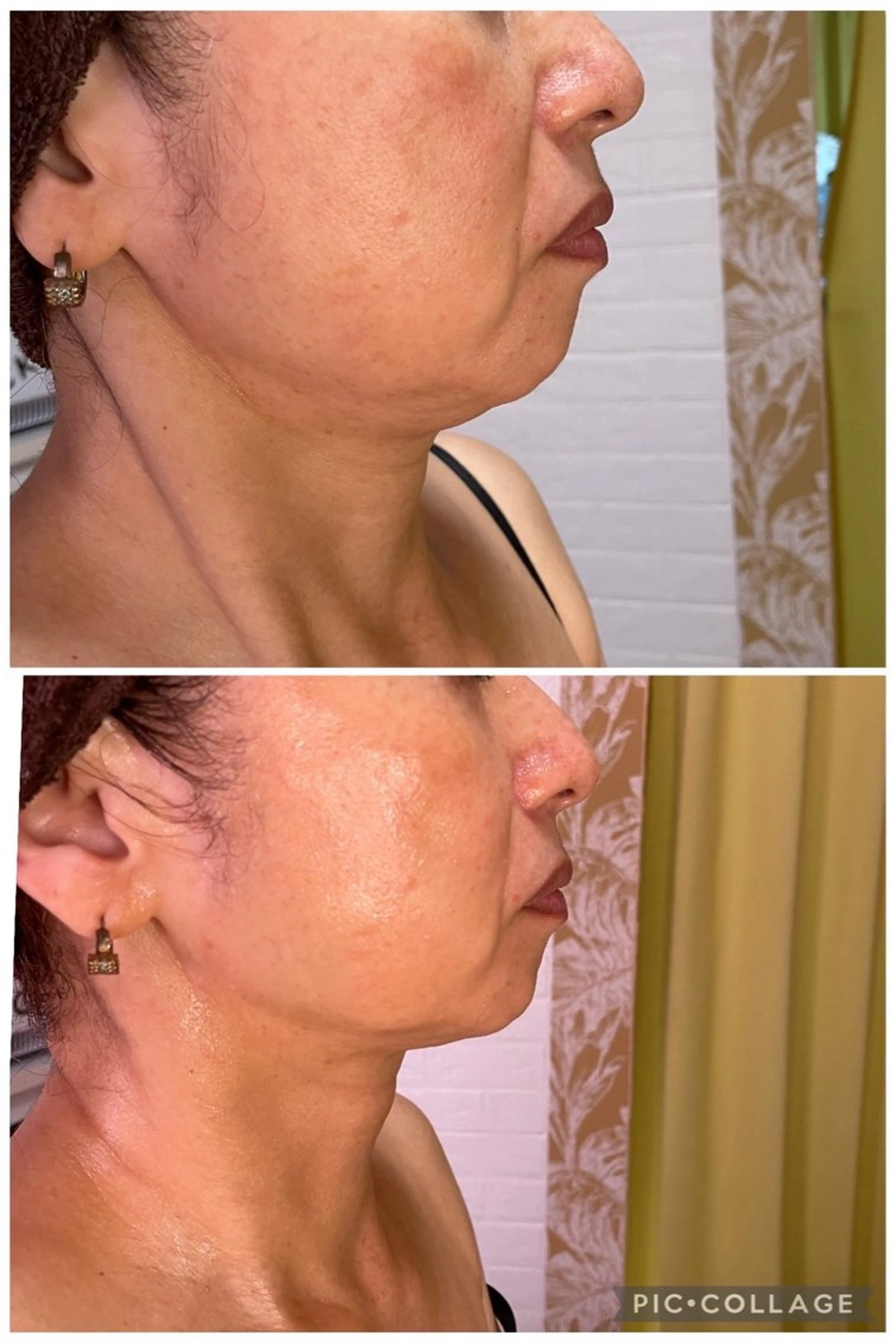 エステ リラク まいまい／八尾／JR 久宝寺／サロンのエステ・リラクイメージ