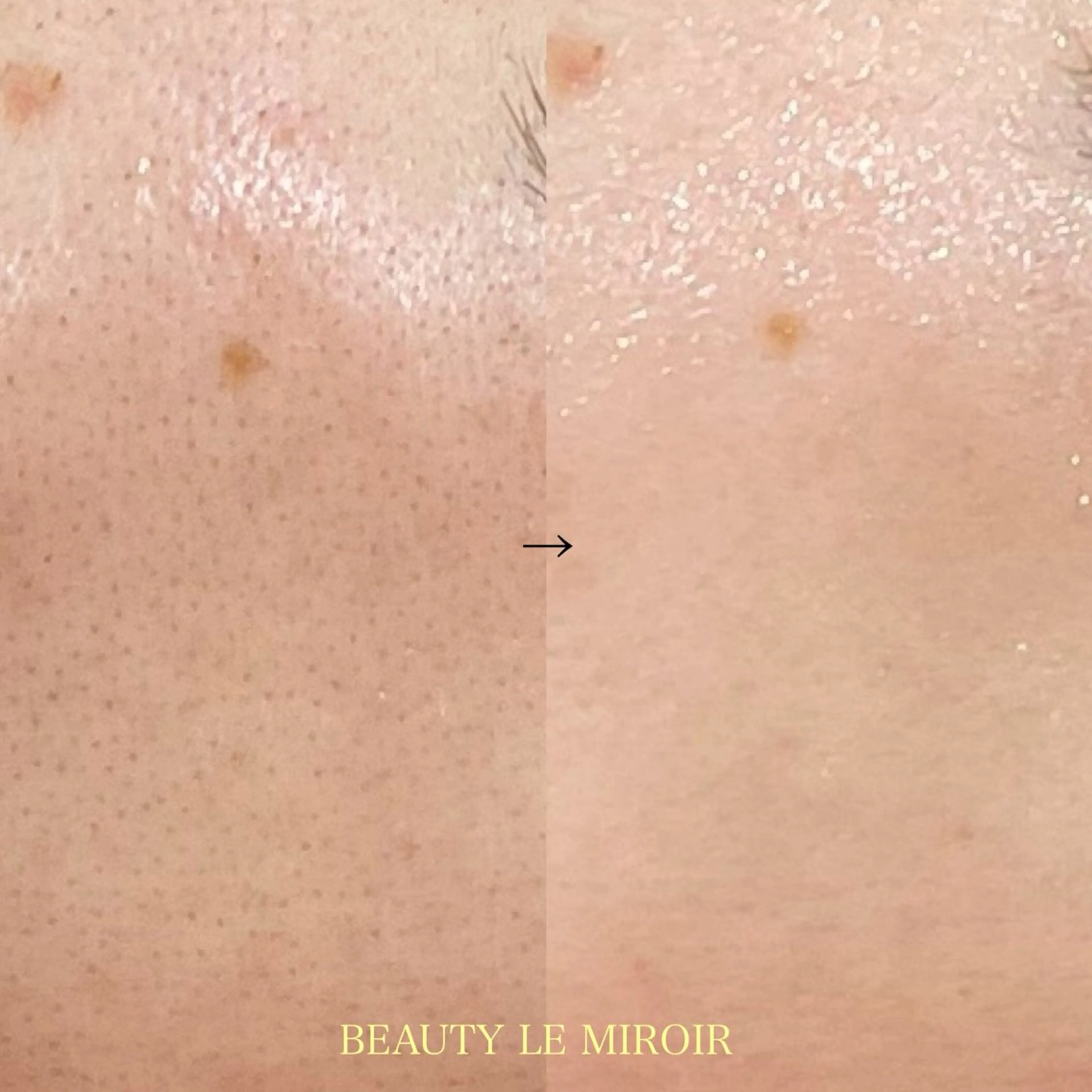 エステ ビューティー ミロワールのエステ・リラクイメージ