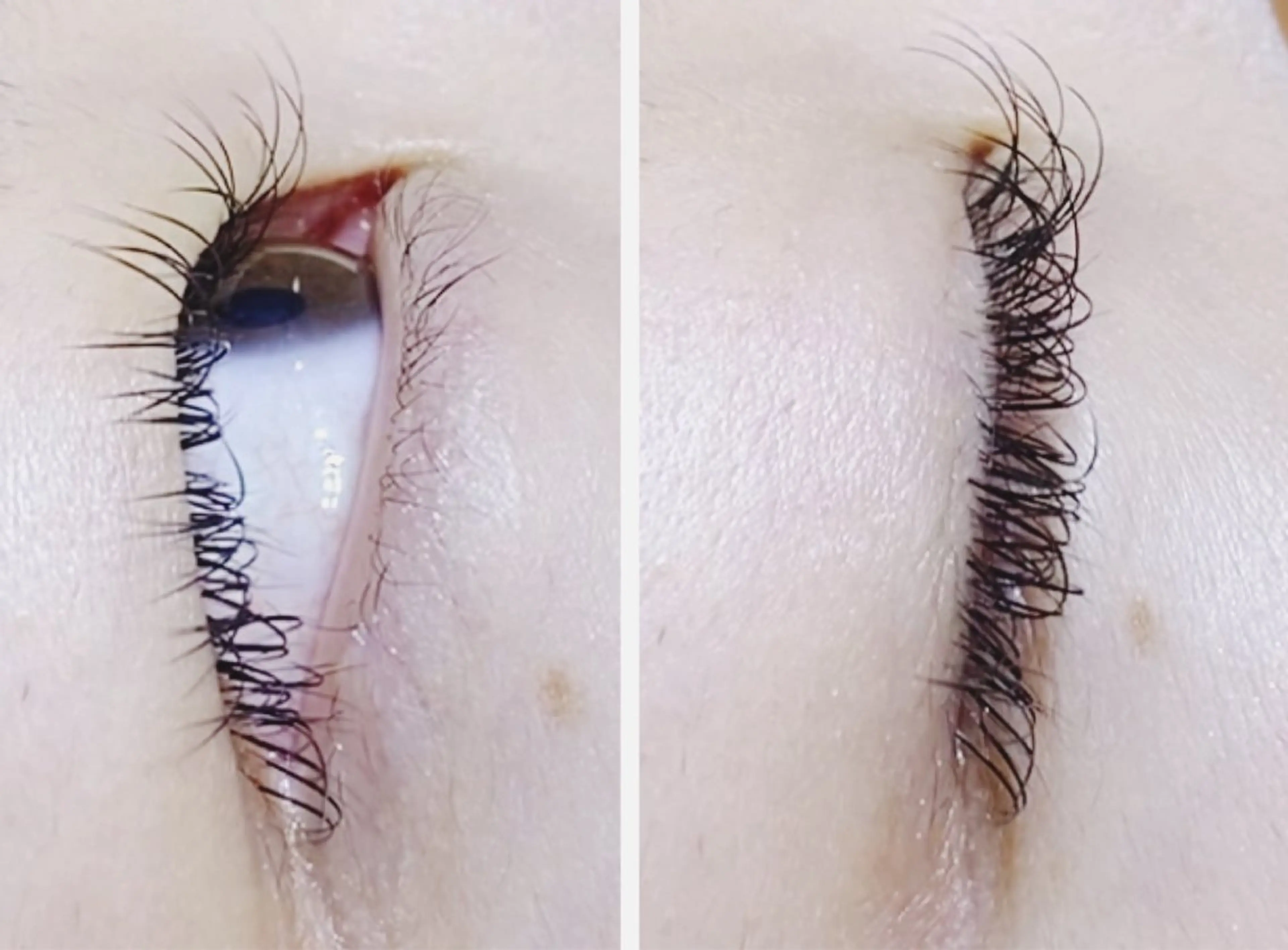 🔷🔶フラットラッシュ　１００本+育毛トリートメント（アイシャンプー・オフ込み）🔶🔷の写真