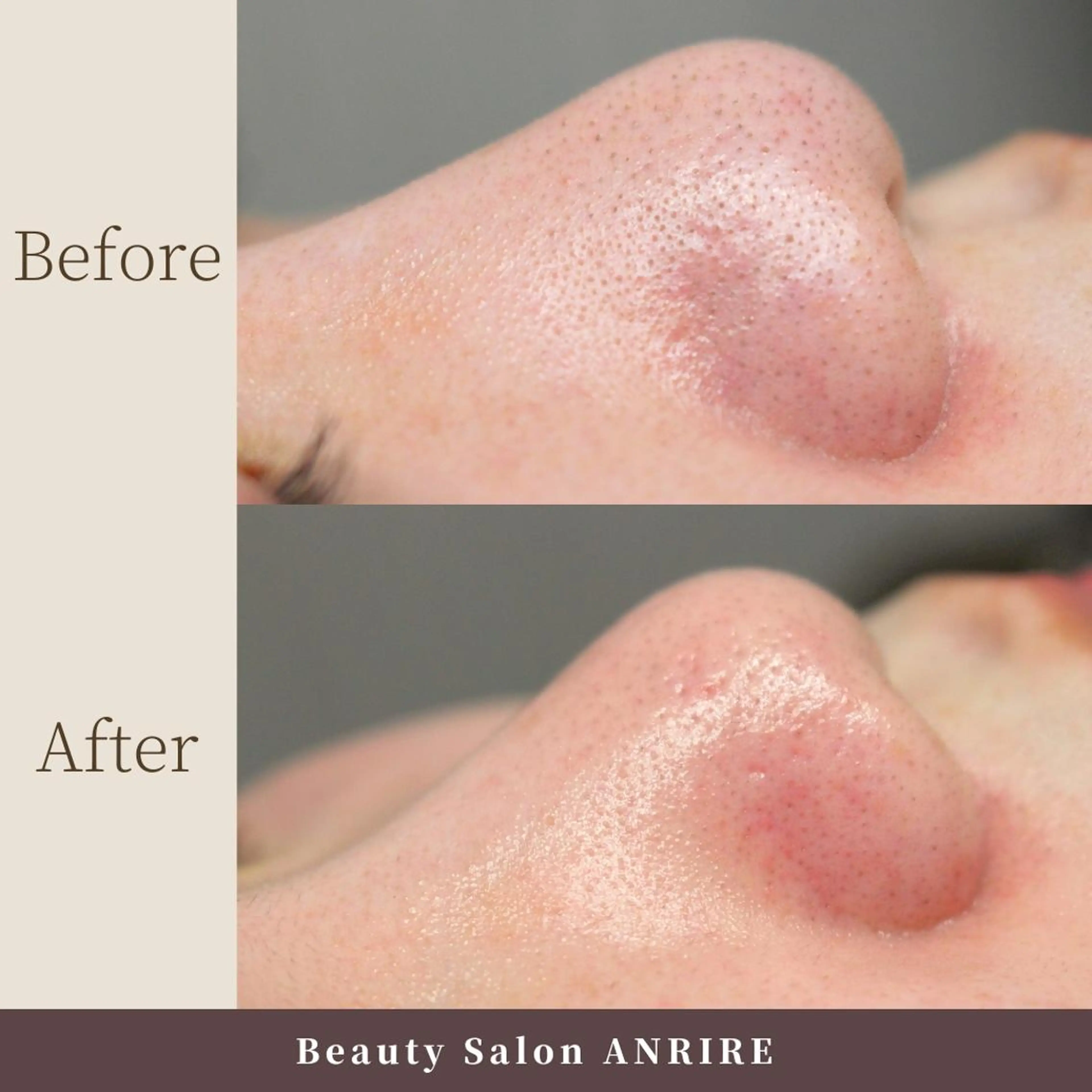 エステ ANRIRE (アンリール)のエステ・リラクイメージ