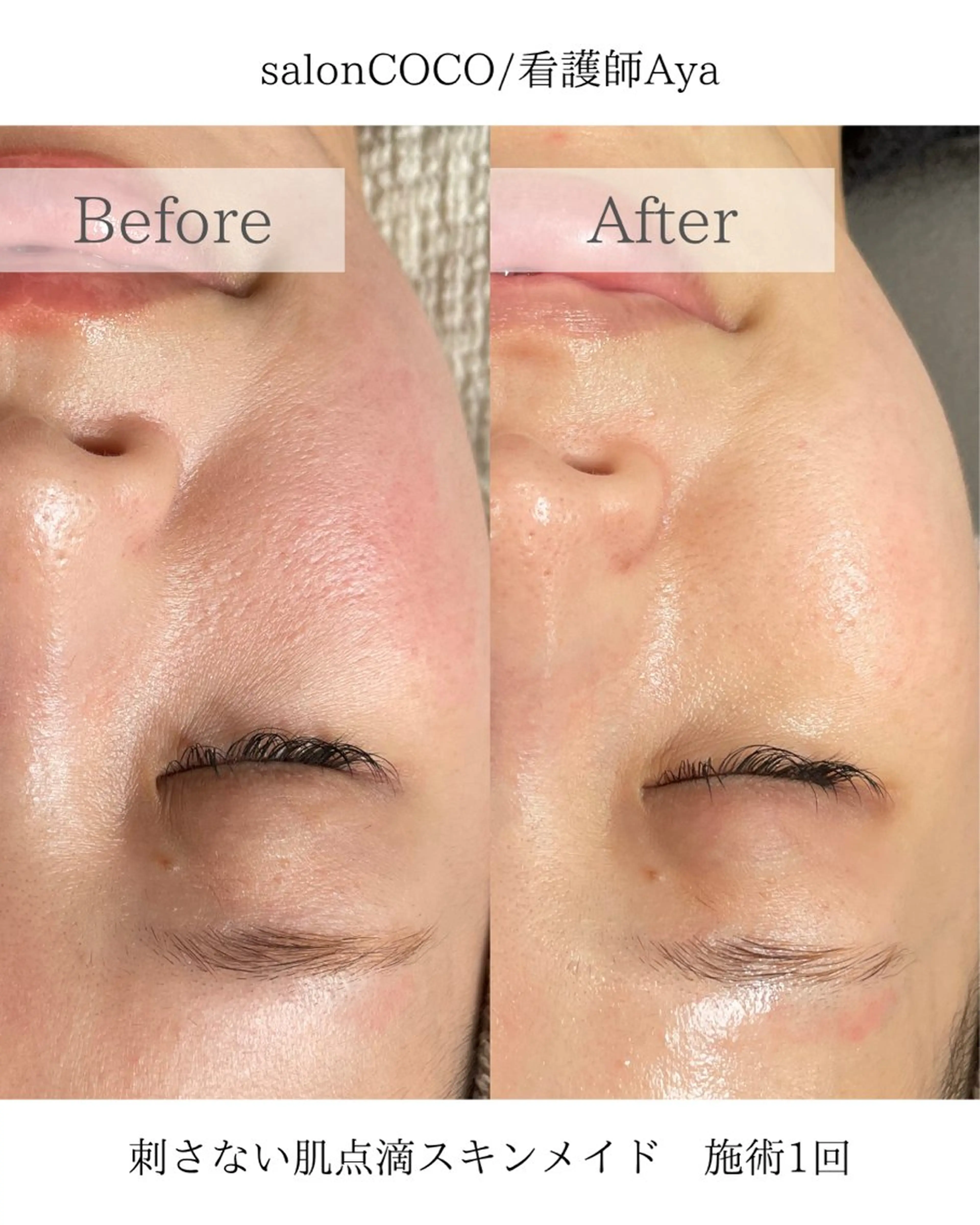 エステ salonCOCO所属・肌管理看護師💎 salonCOCOのエステ・リラクイメージ