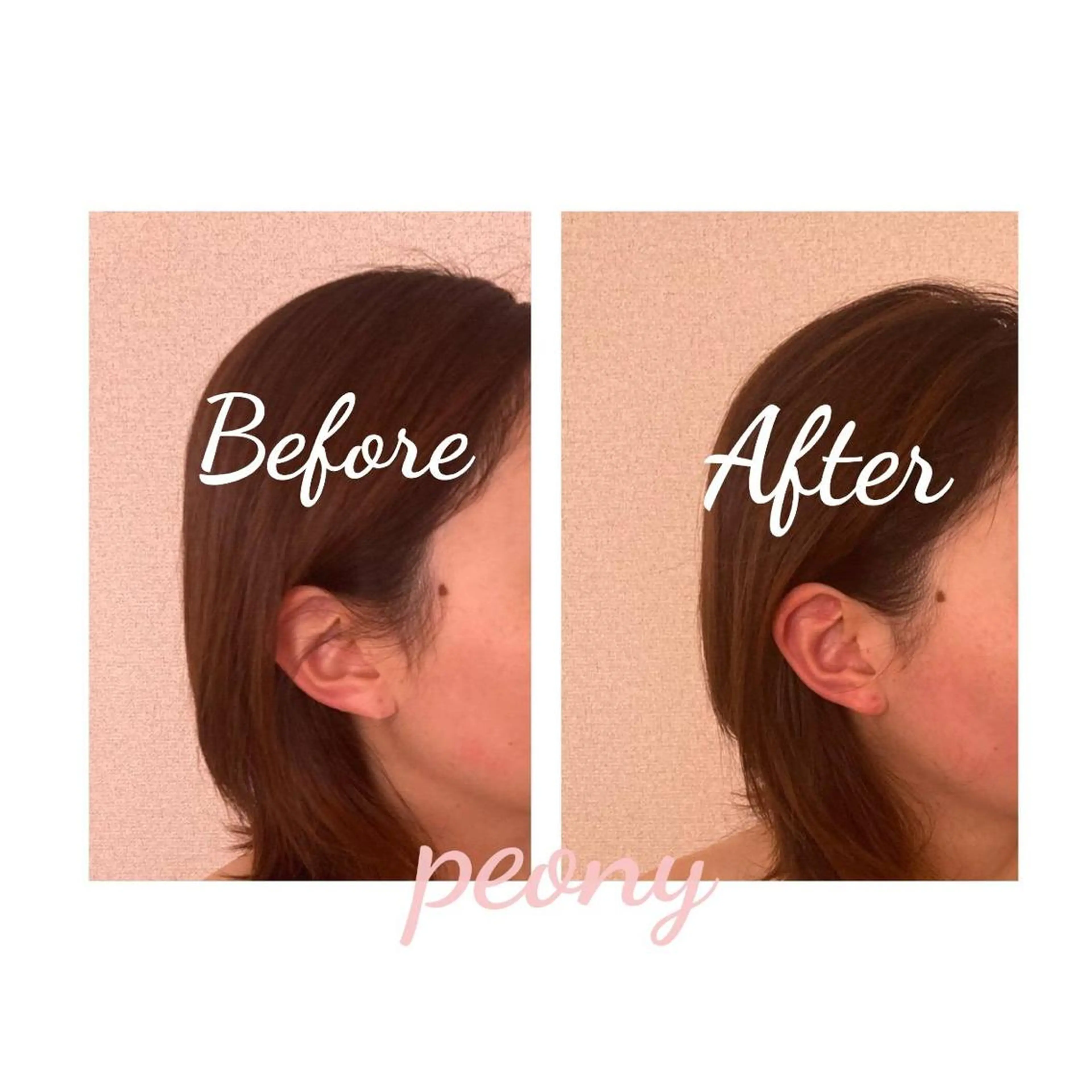 デトックス美容専門サロンｐｅｏｎｙ所属・デトックス美容専門 サロンｐｅｏｎｙのエステ・リラクイメージ