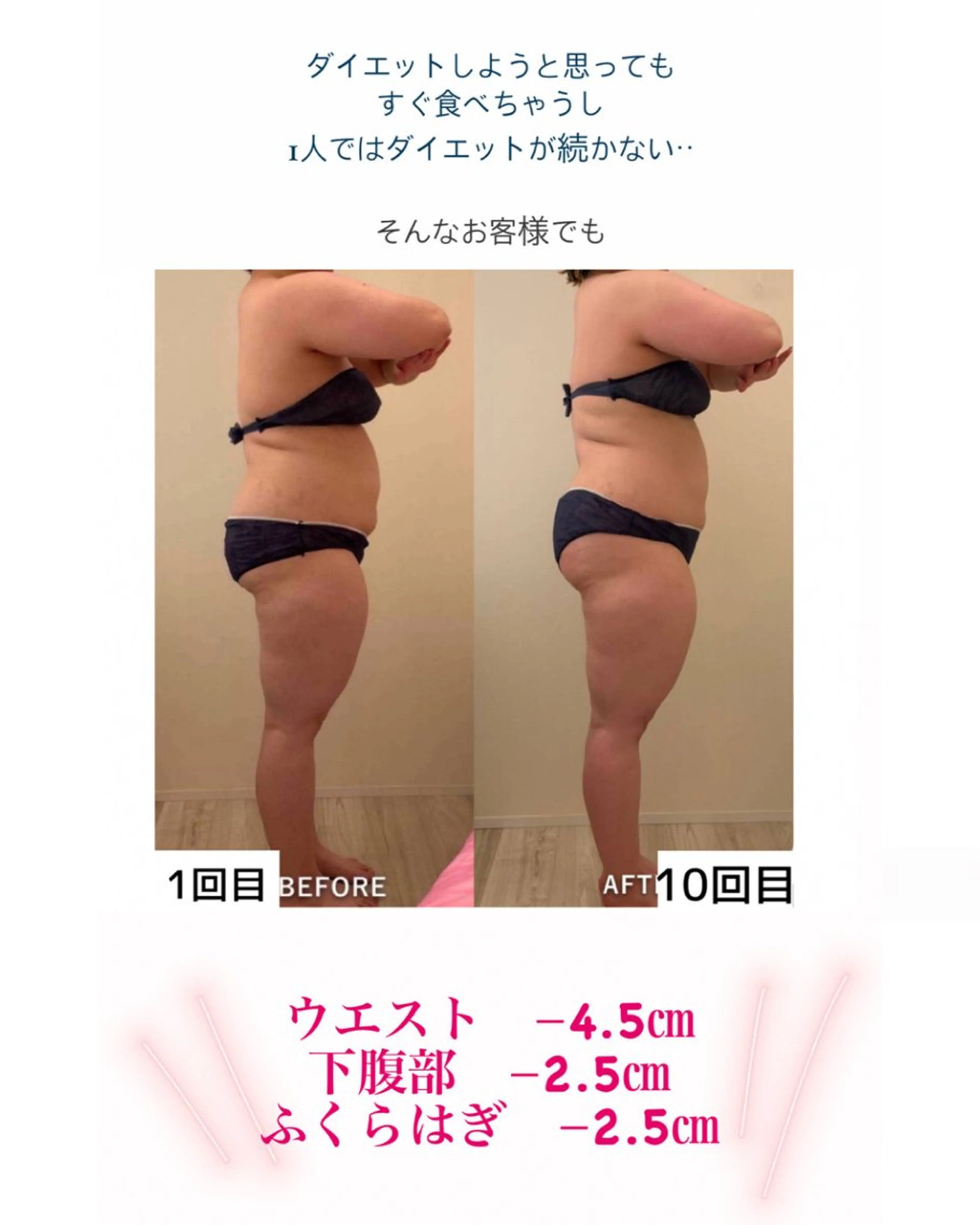 産後ダイエット−9㎏ Pourvous結衣のエステ・リラクイメージ