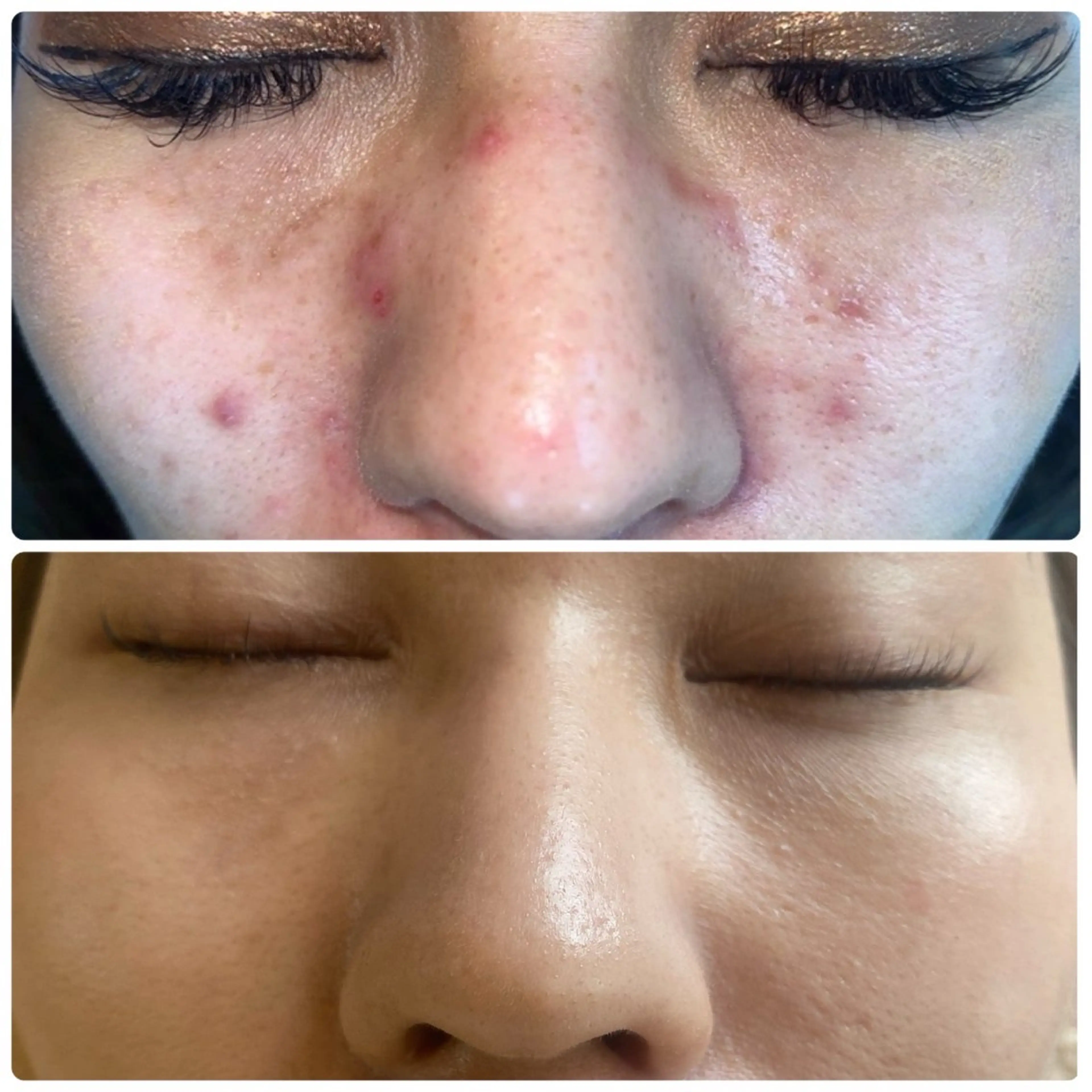 GRACEZ ｸﾞﾚｰｼｽﾞのエステ・リラクイメージ