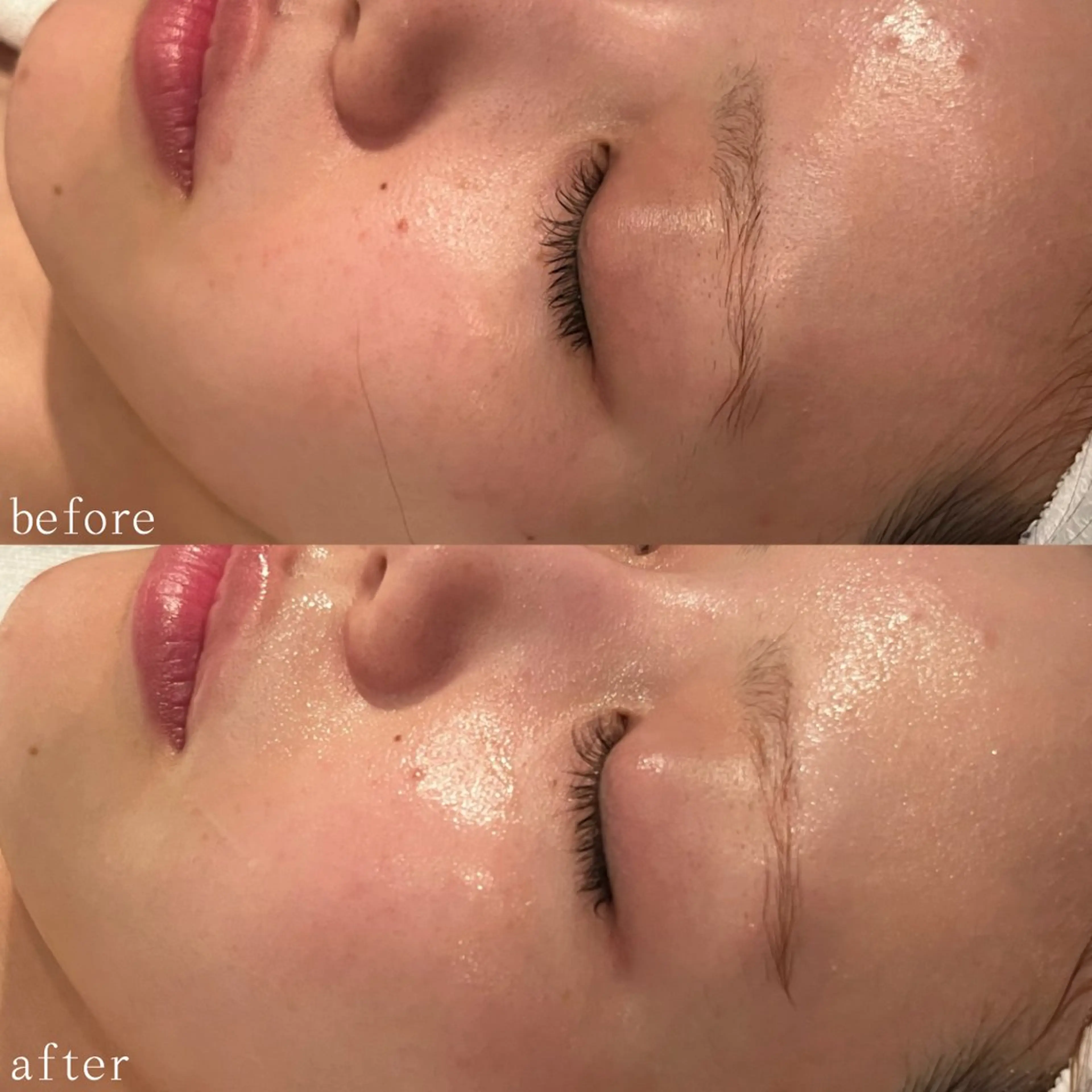 デ・アイム心斎橋所属・肌質改善サロン🫧 MAIのエステ・リラクイメージ