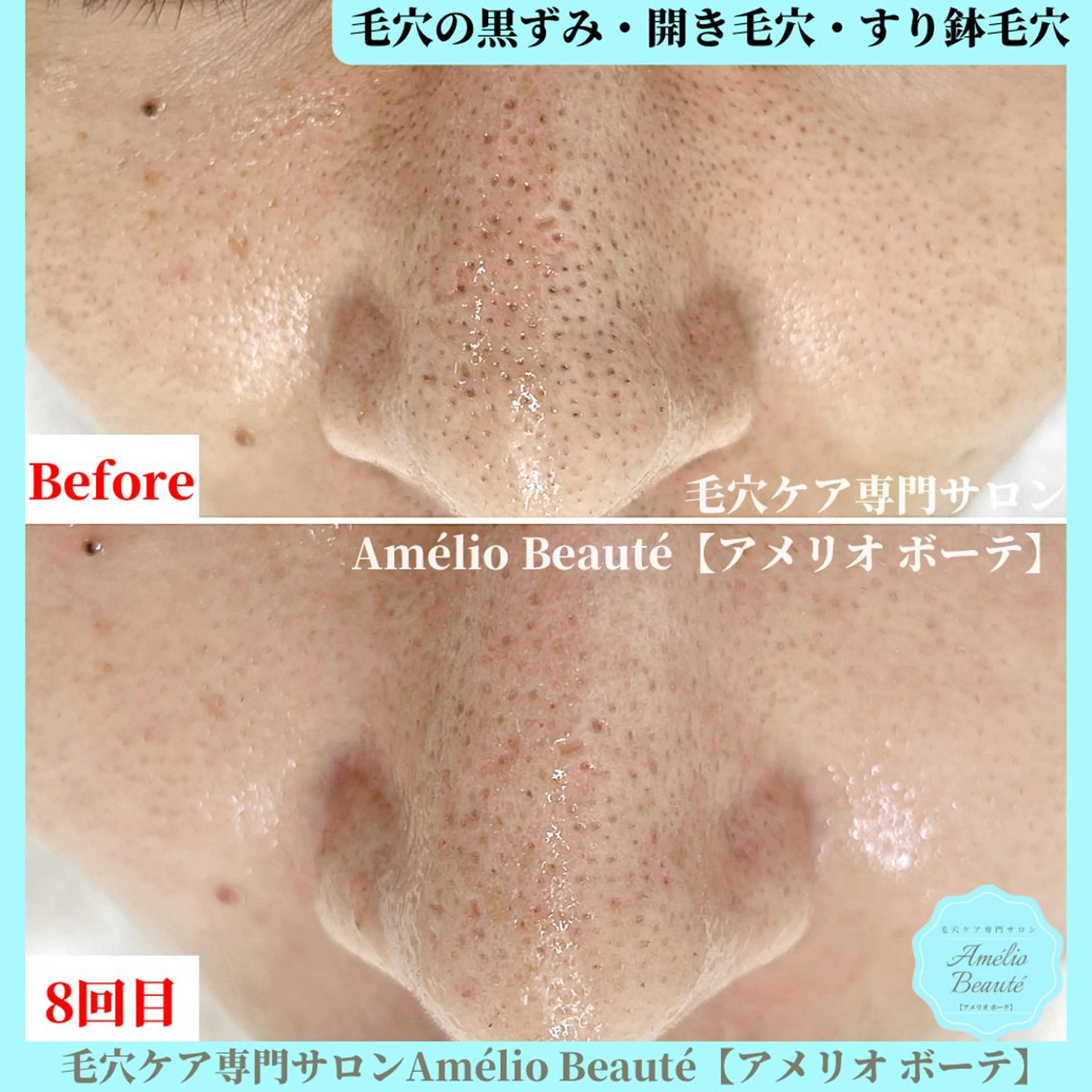 毛穴ケア専門サロン Amélio Beauté所属・毛穴ケア専門サロン アメリオボーテのその他イメージ