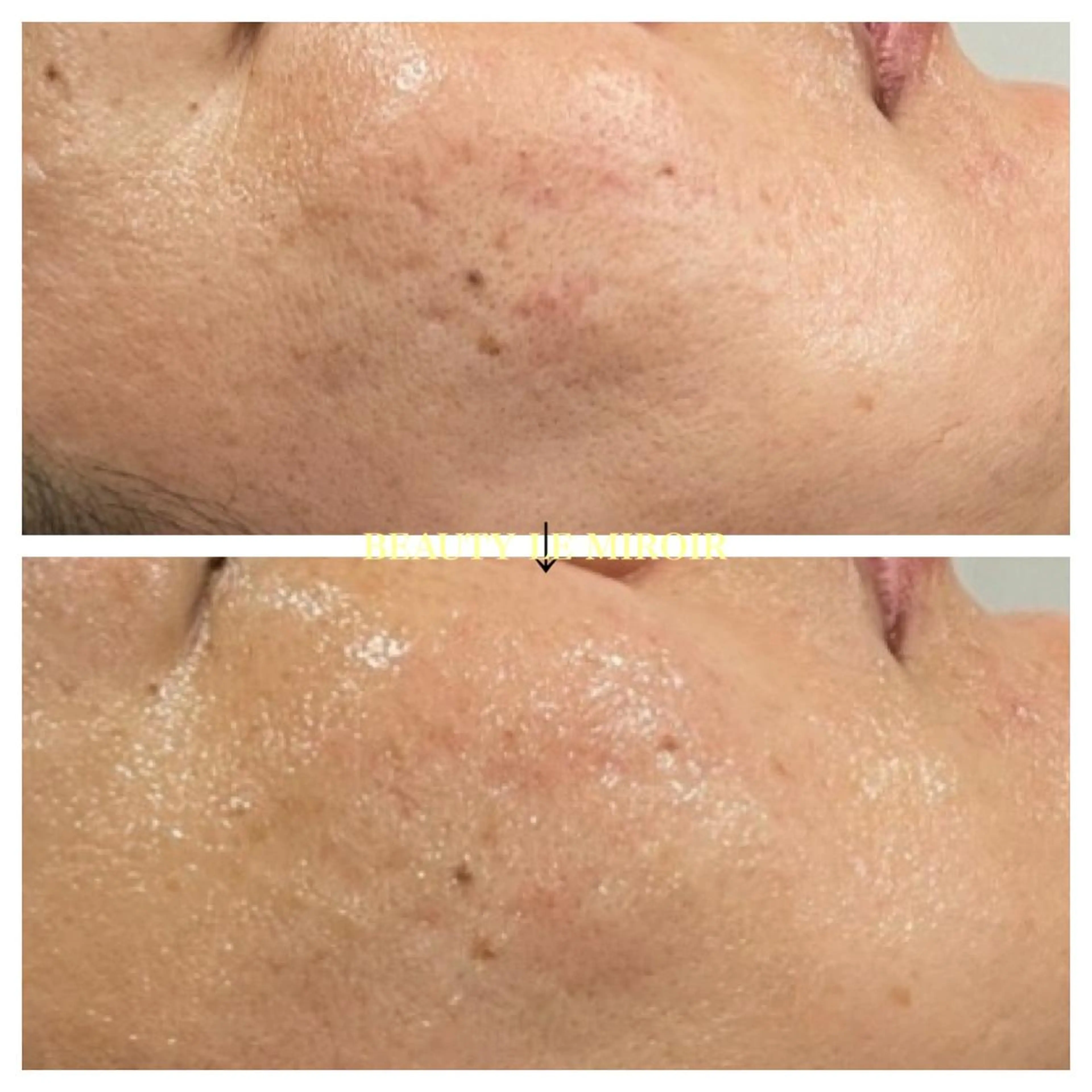 マツエク・マツパ ビューティー ミロワールのエステ・リラクイメージ