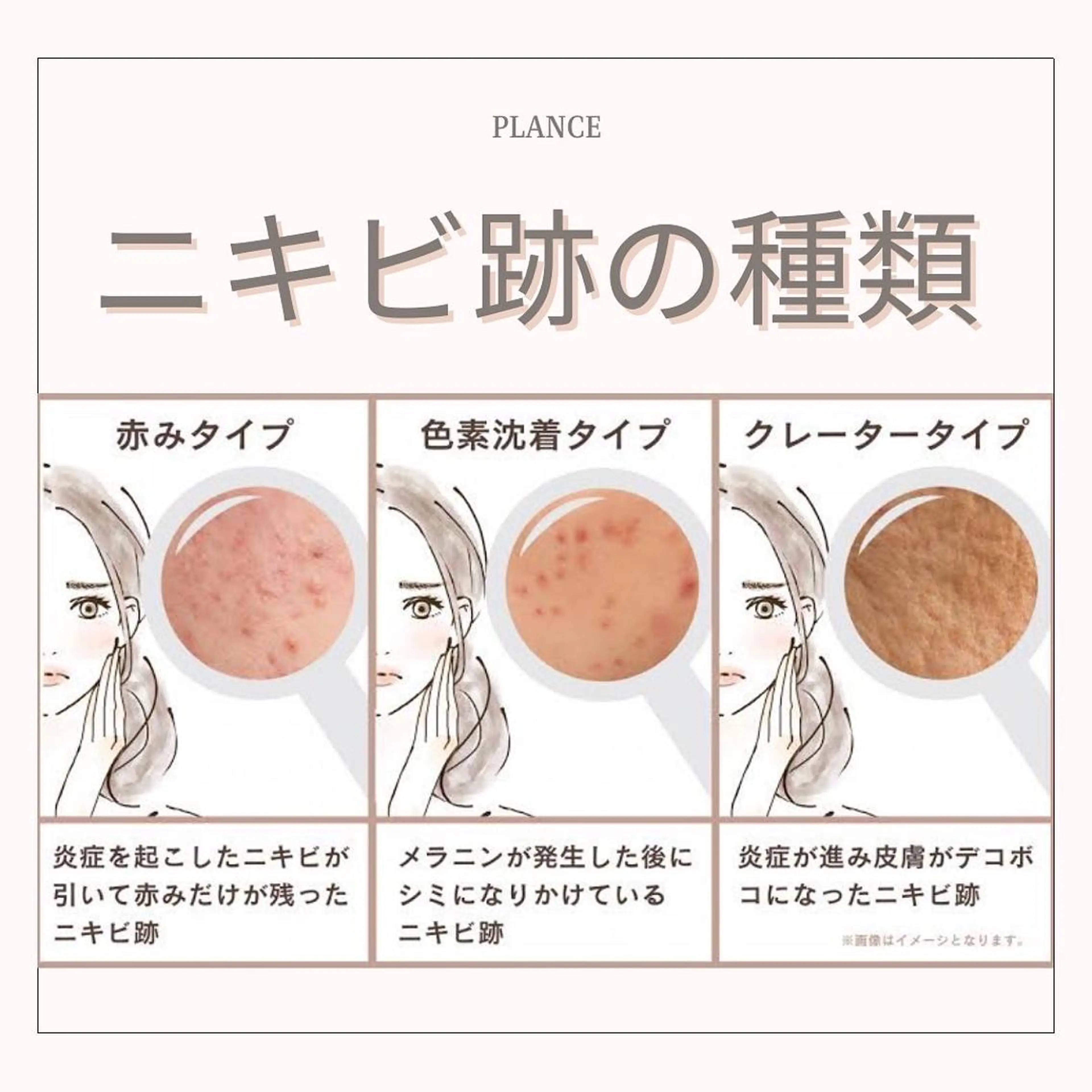 エステ フェイシャル専門 肌質改善/プランスのエステ・リラクイメージ