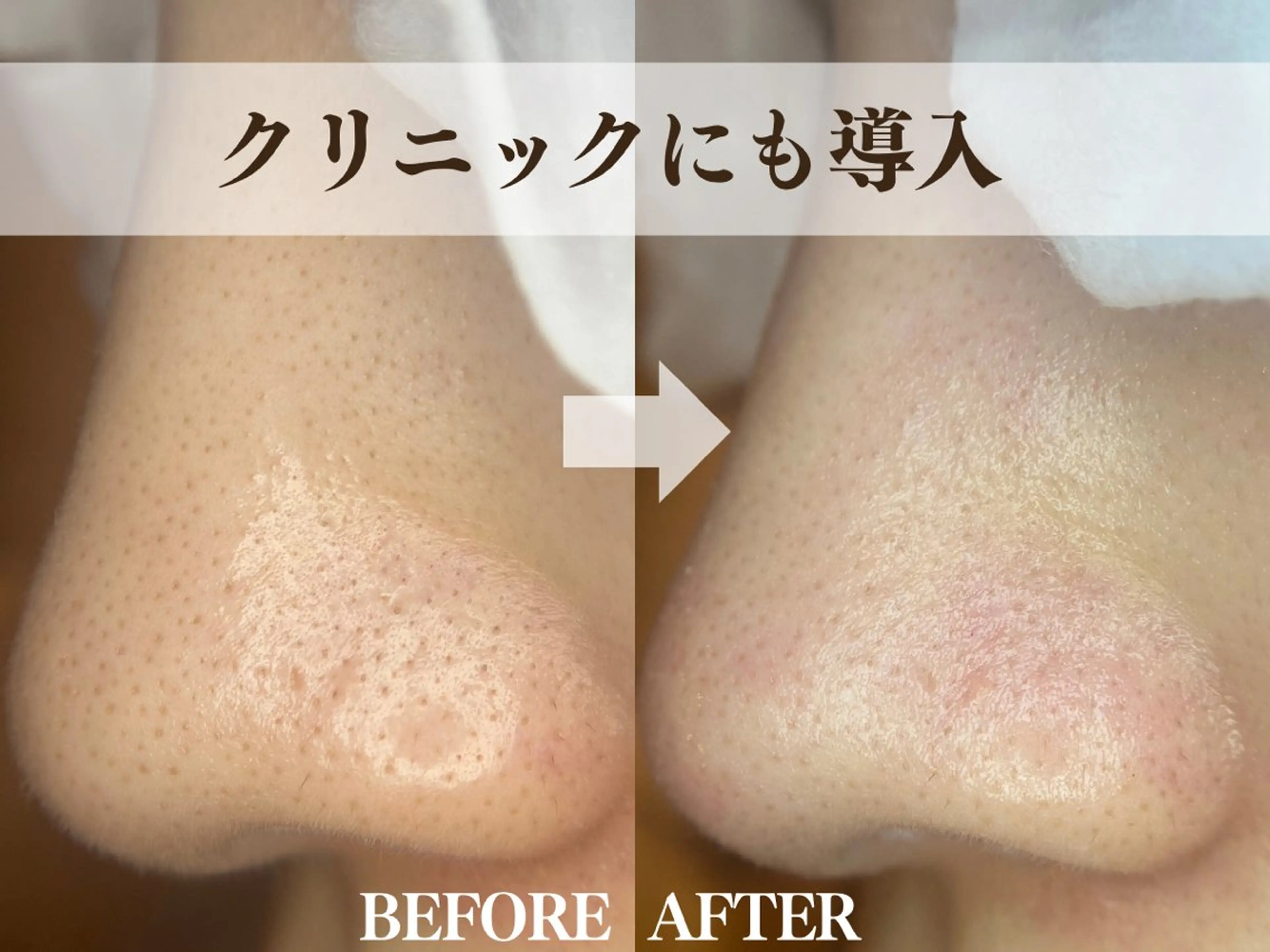 エステ salon MUSUBUのエステ・リラクイメージ