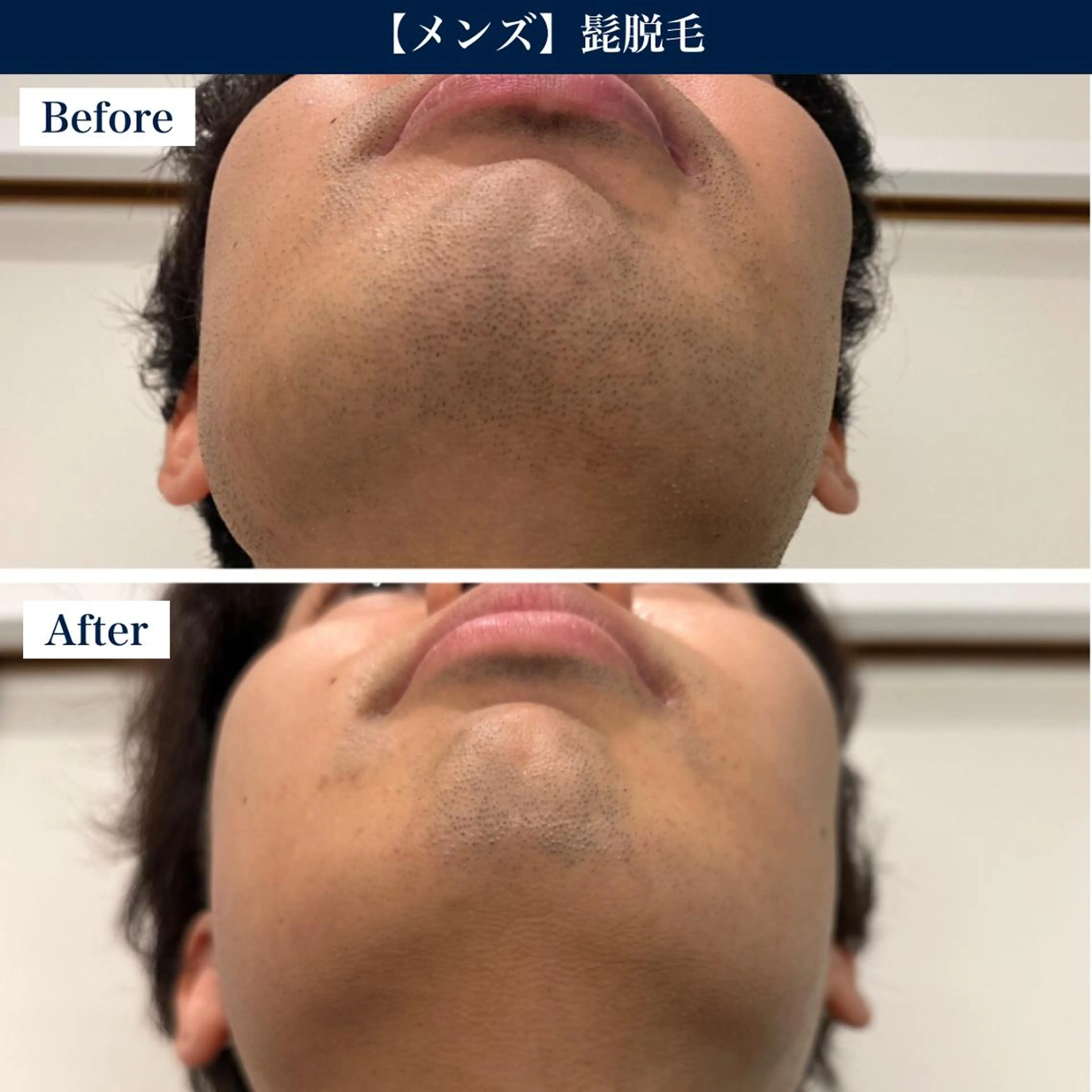 【メンズ脱毛・美肌】 SARA 恵比寿店のエステ・リラクイメージ