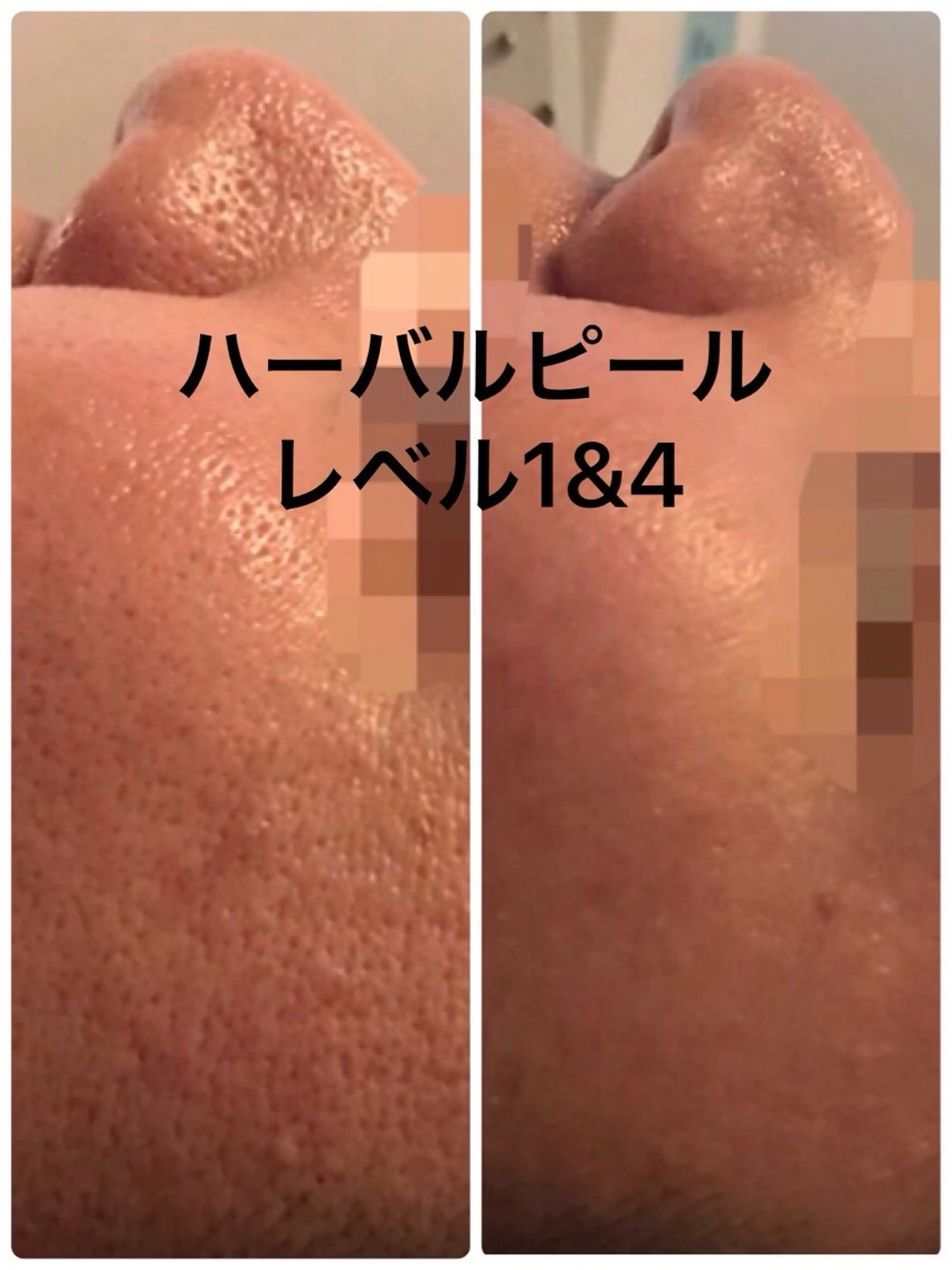 エステ エステティック sala藤沢のエステ・リラクイメージ