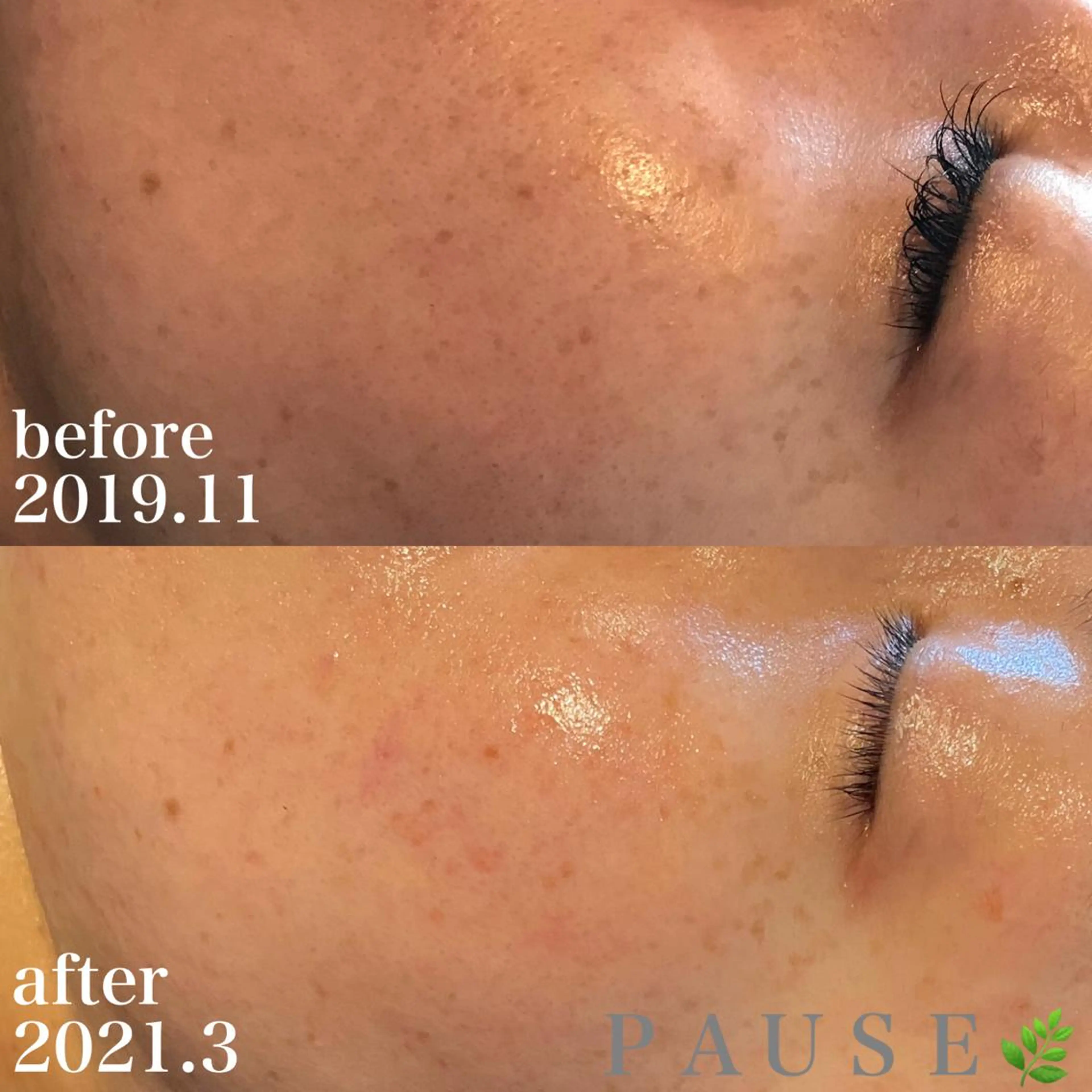 エステ 浜野 恵美のエステ・リラクイメージ