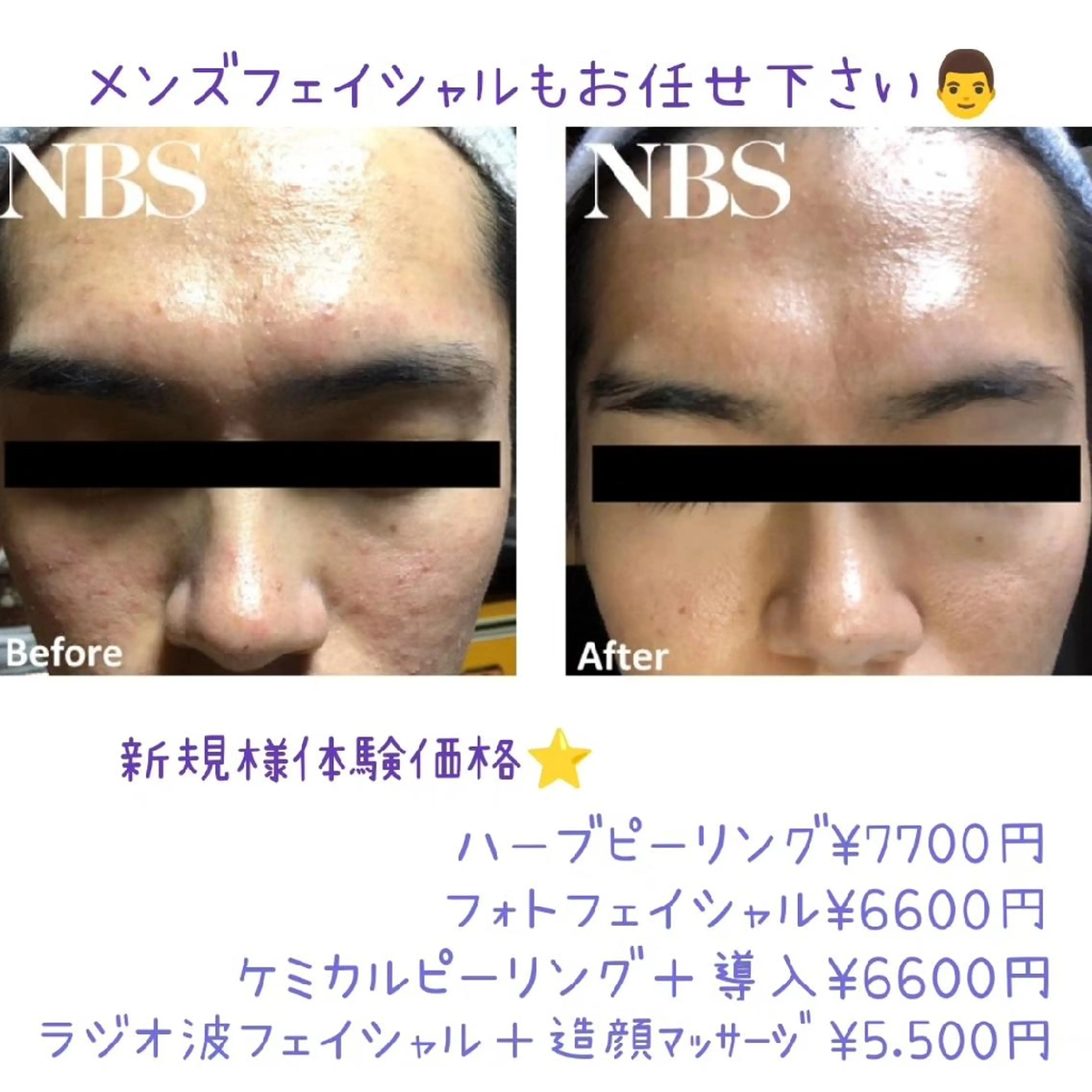 メンズ LaCure～ﾗｷｭｱ～所属・岩田 亜季のエステ・リラクイメージ