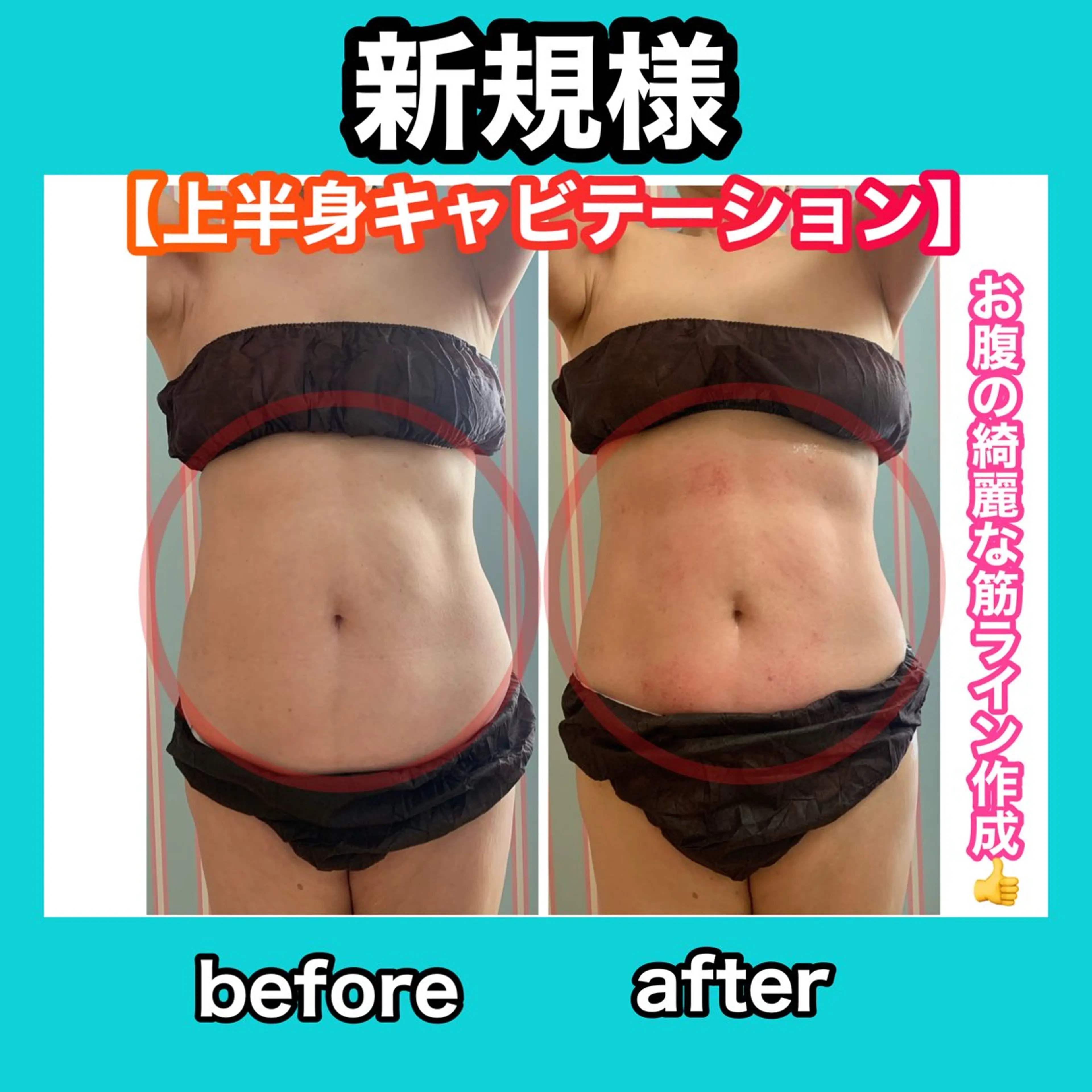 エステ リラク 痩身/脱毛/ネイル HARUKAのエステ・リラクイメージ