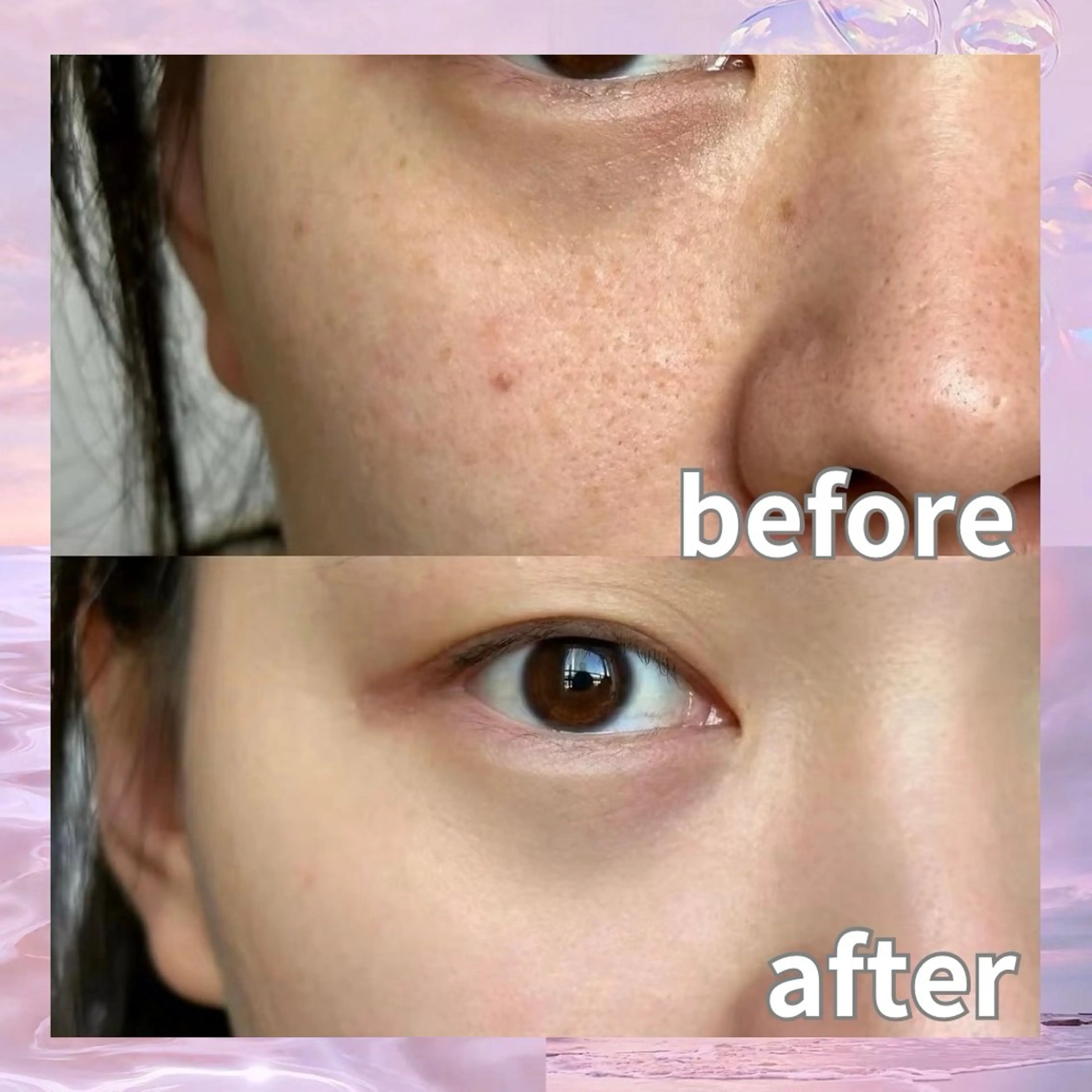 マツエク・マツパ エステ リラク 愛維美水光美肌専門店所属・愛維美水光美肌専門店 メンズレディースokのエステ・リラクイメージ