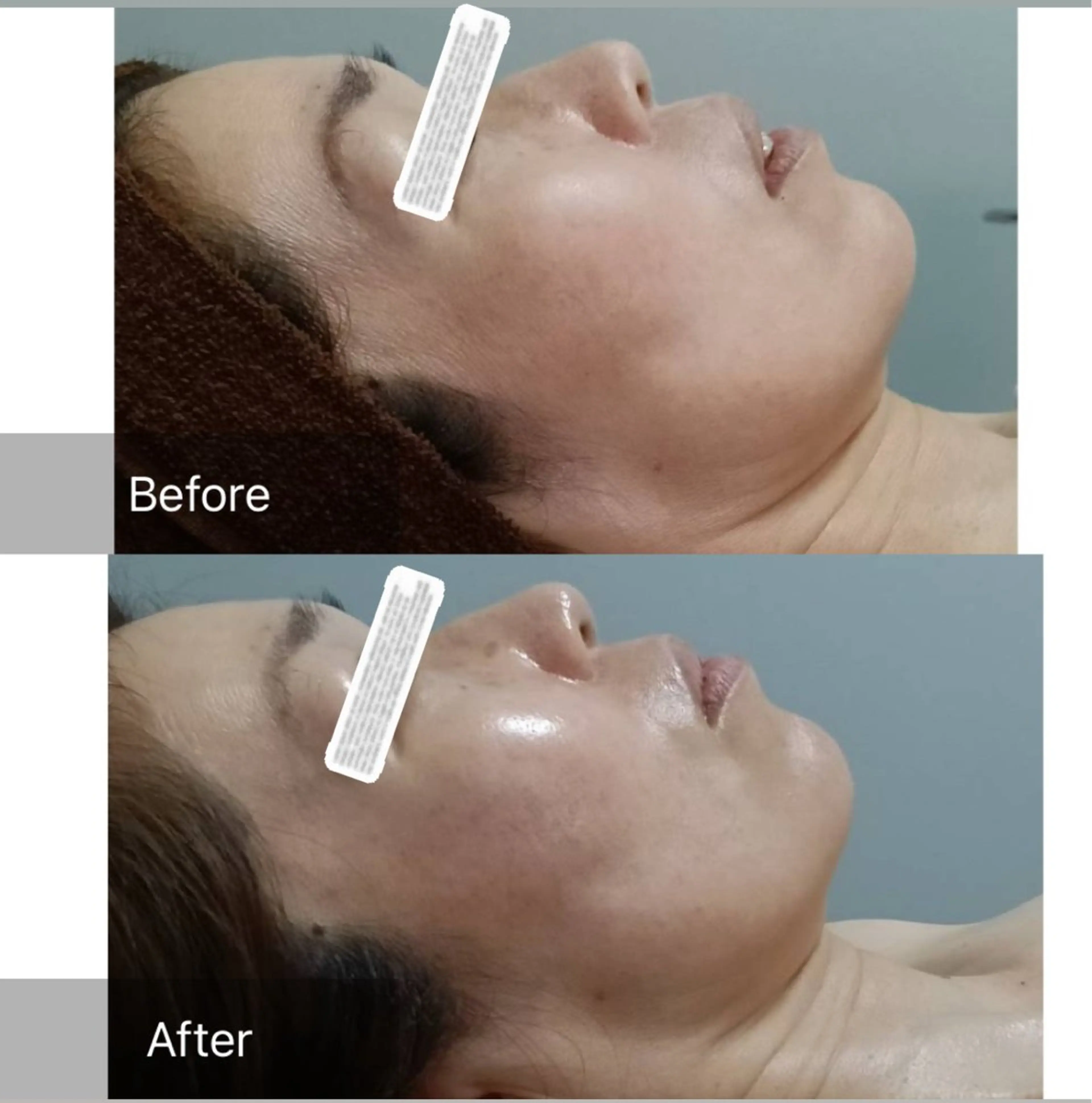 エステ KatoreA カトレアのエステ・リラクイメージ