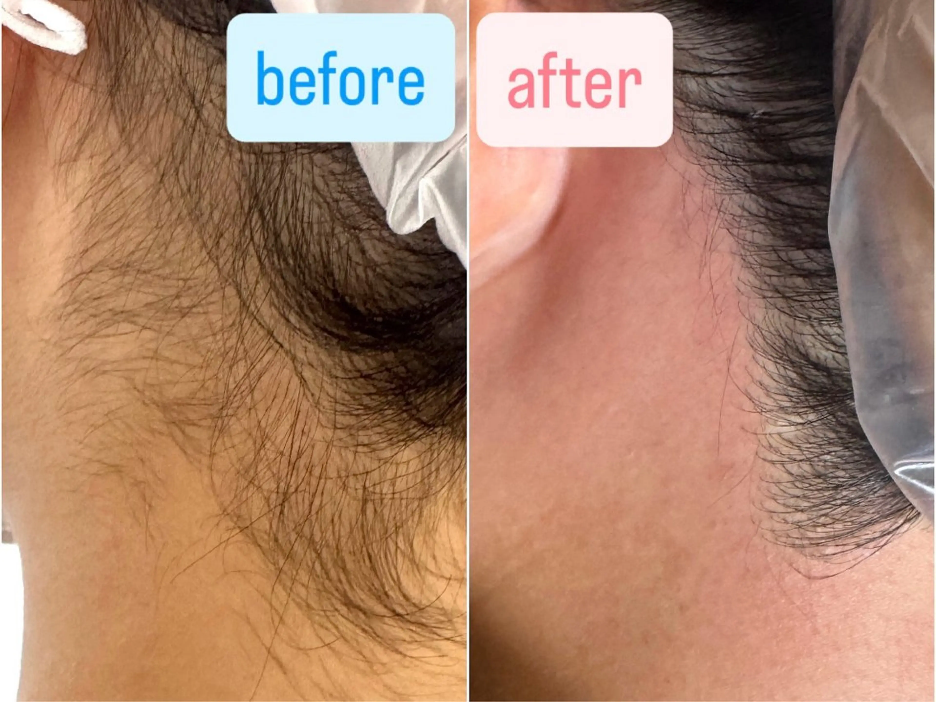 ワックス脱毛 yuuri. Sの眉毛・アイブロウイメージ