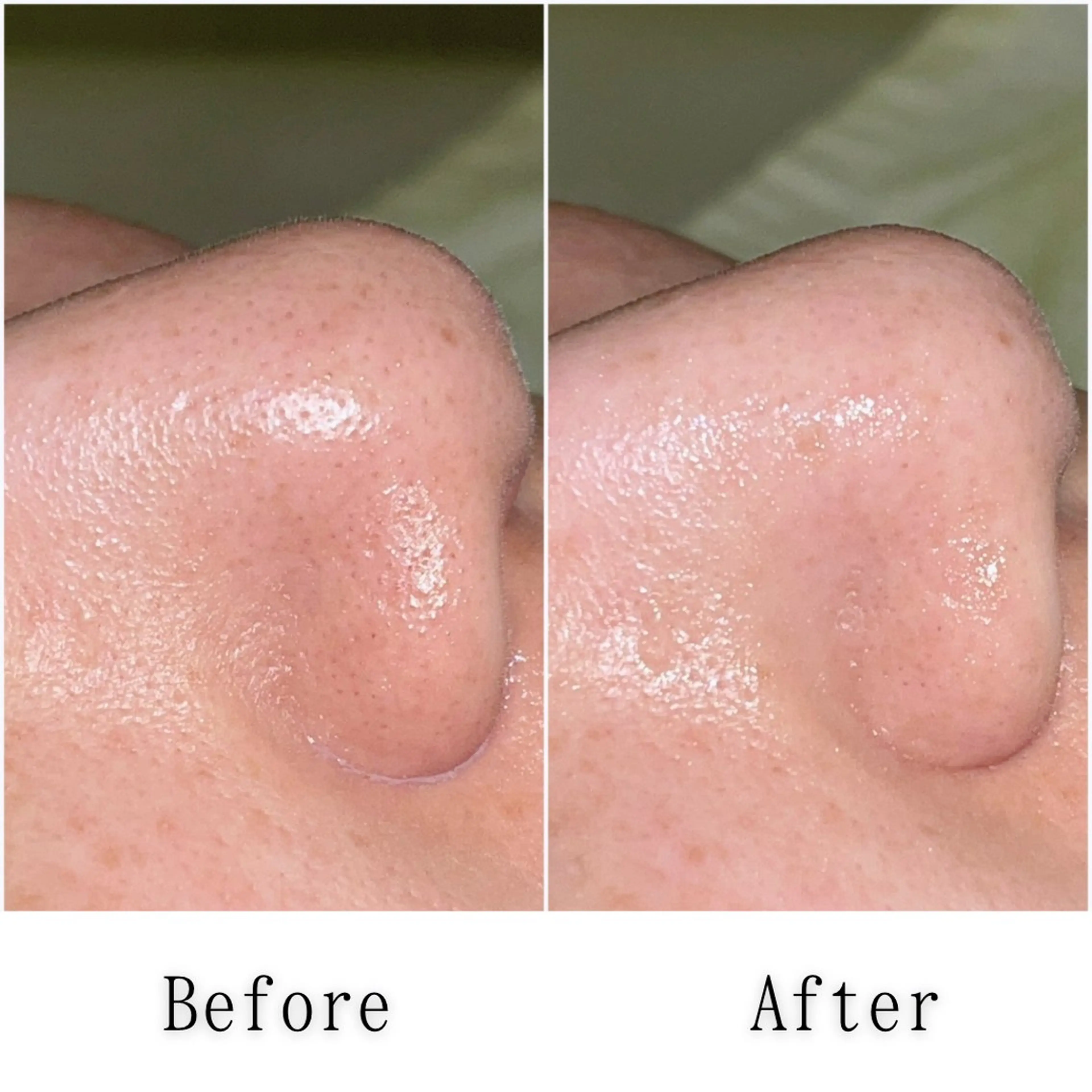 エステ SELF  BEAUTY gracia浦添店所属・gracia 浦添店のその他イメージ