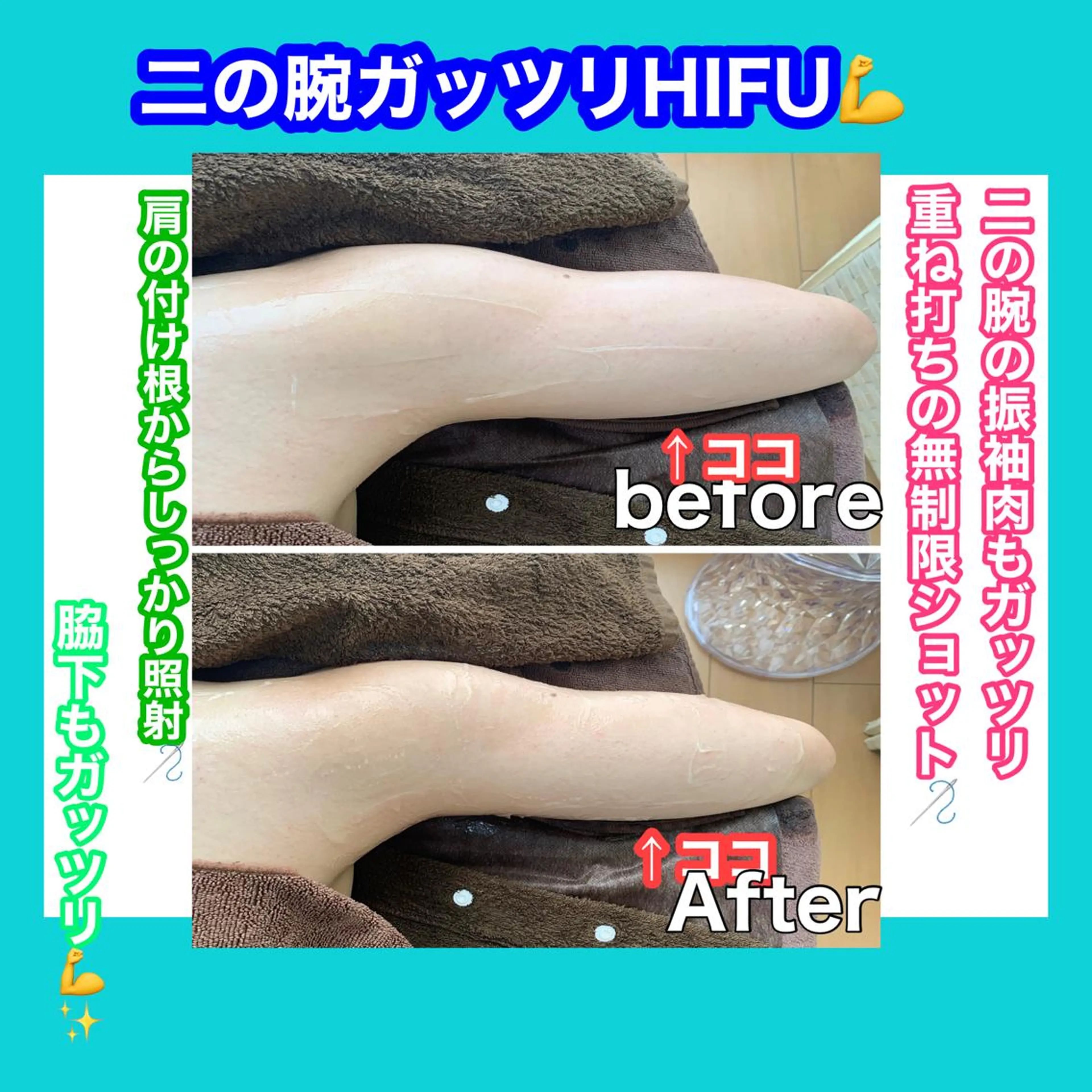 痩身/脱毛/ネイル HARUKAのエステ・リラクイメージ