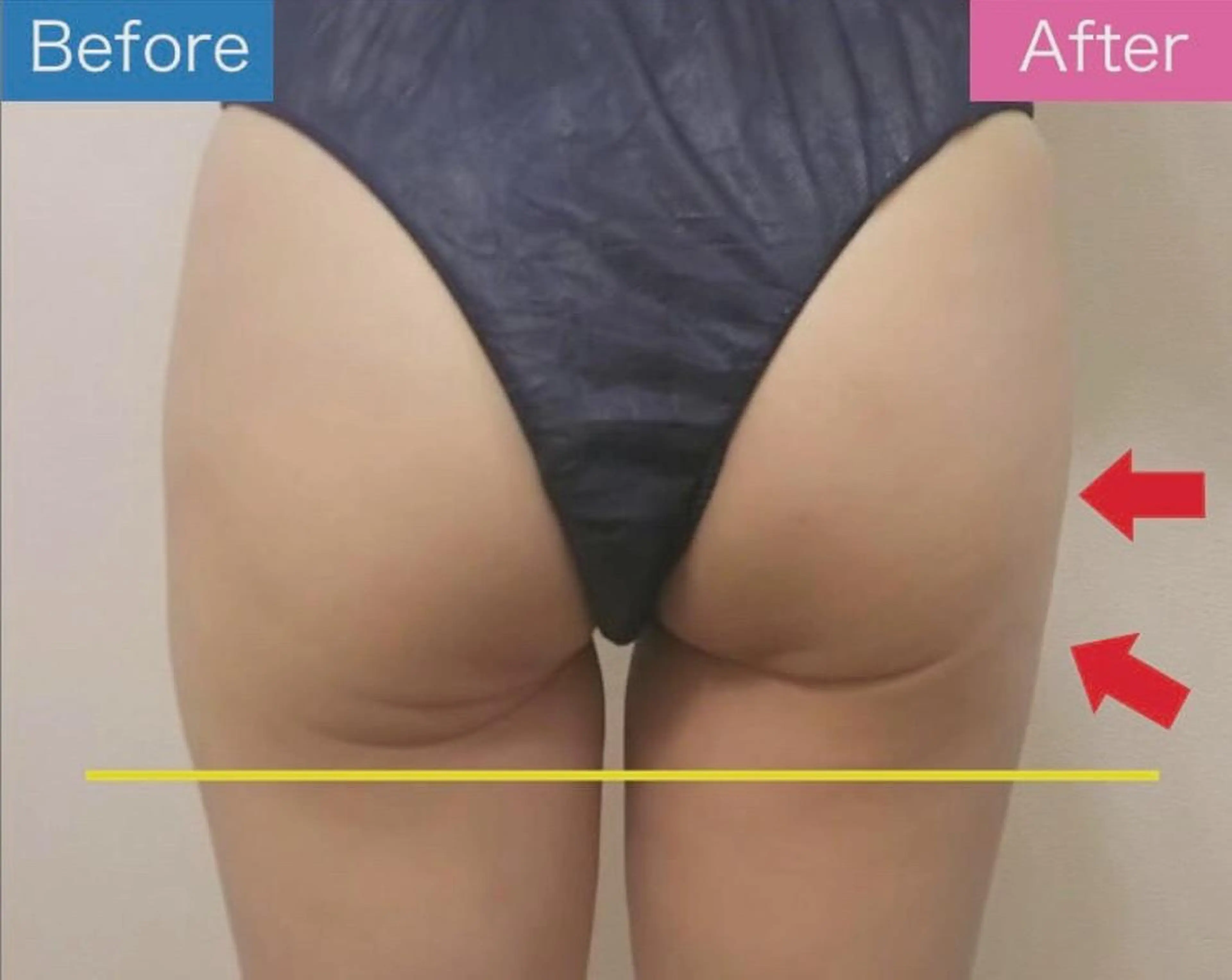 biloop所属・《痩身×疲労改善》 BILOOPのエステ・リラクイメージ