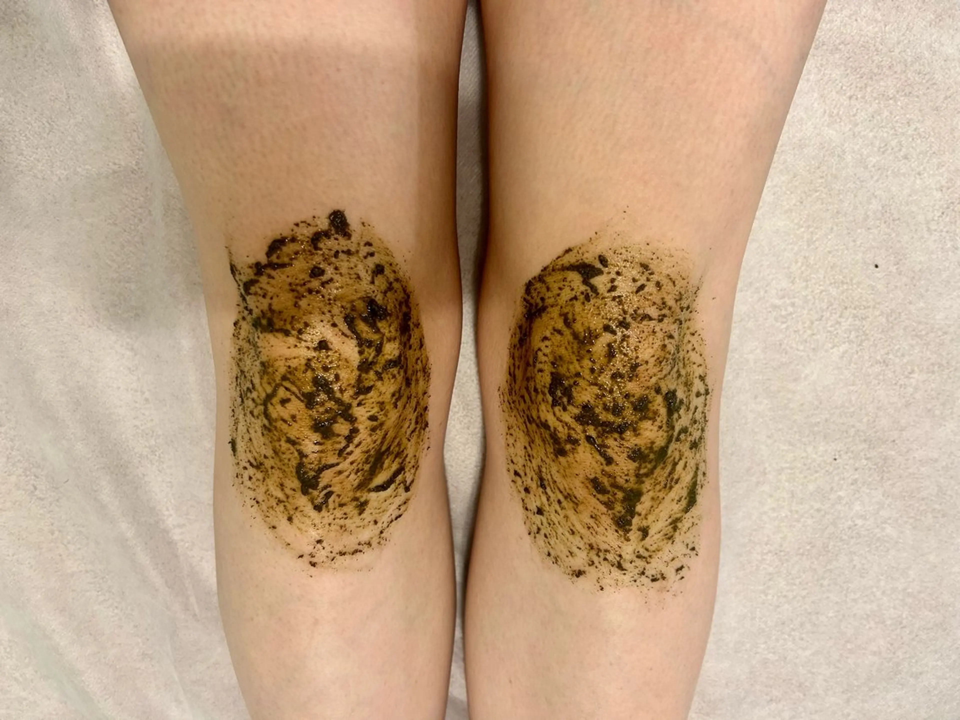 トーンアップ★肘or膝or脇ボディーハーブピーリングの写真