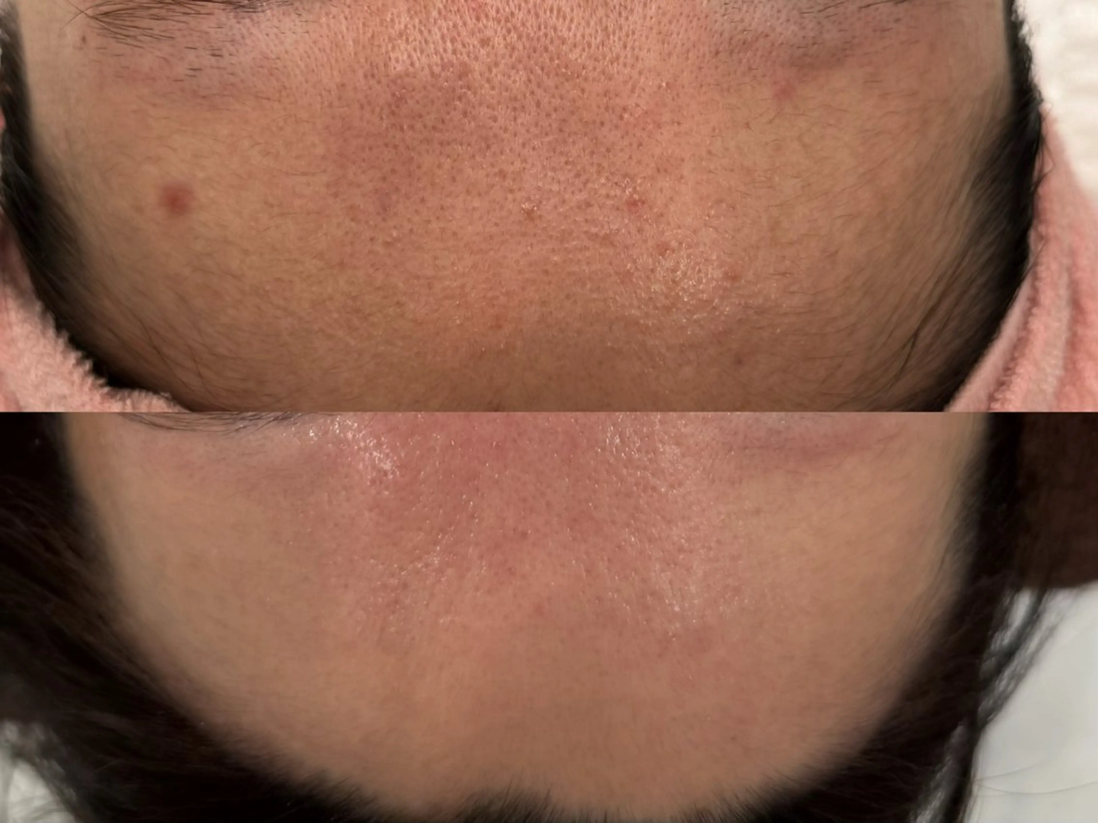 べアール所属・小顔/毛穴/ニキビ salon bealのエステ・リラクイメージ