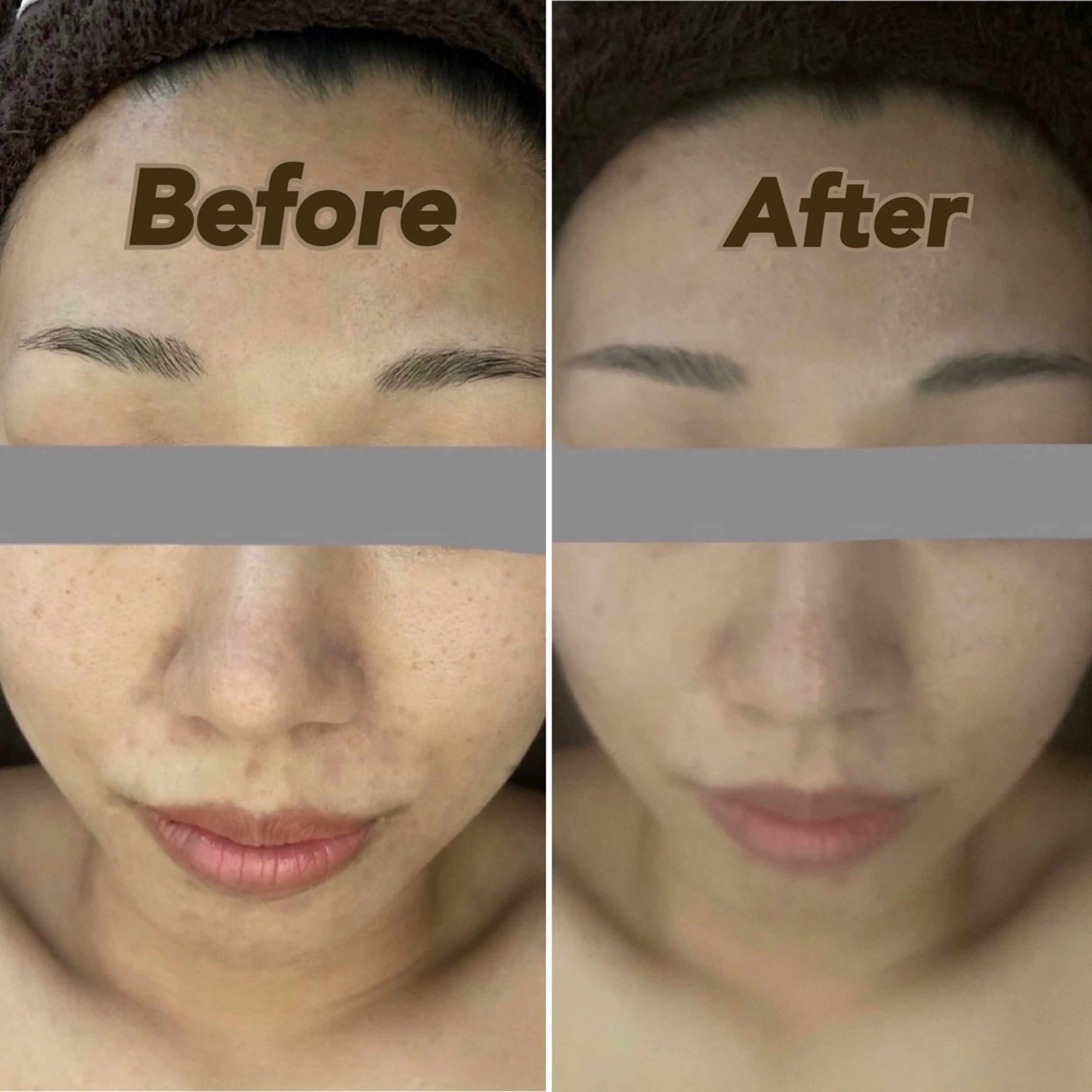 【お写真必須クーポン】フェイシャルのBefore After撮影にご協力いただける方へクーポンの写真