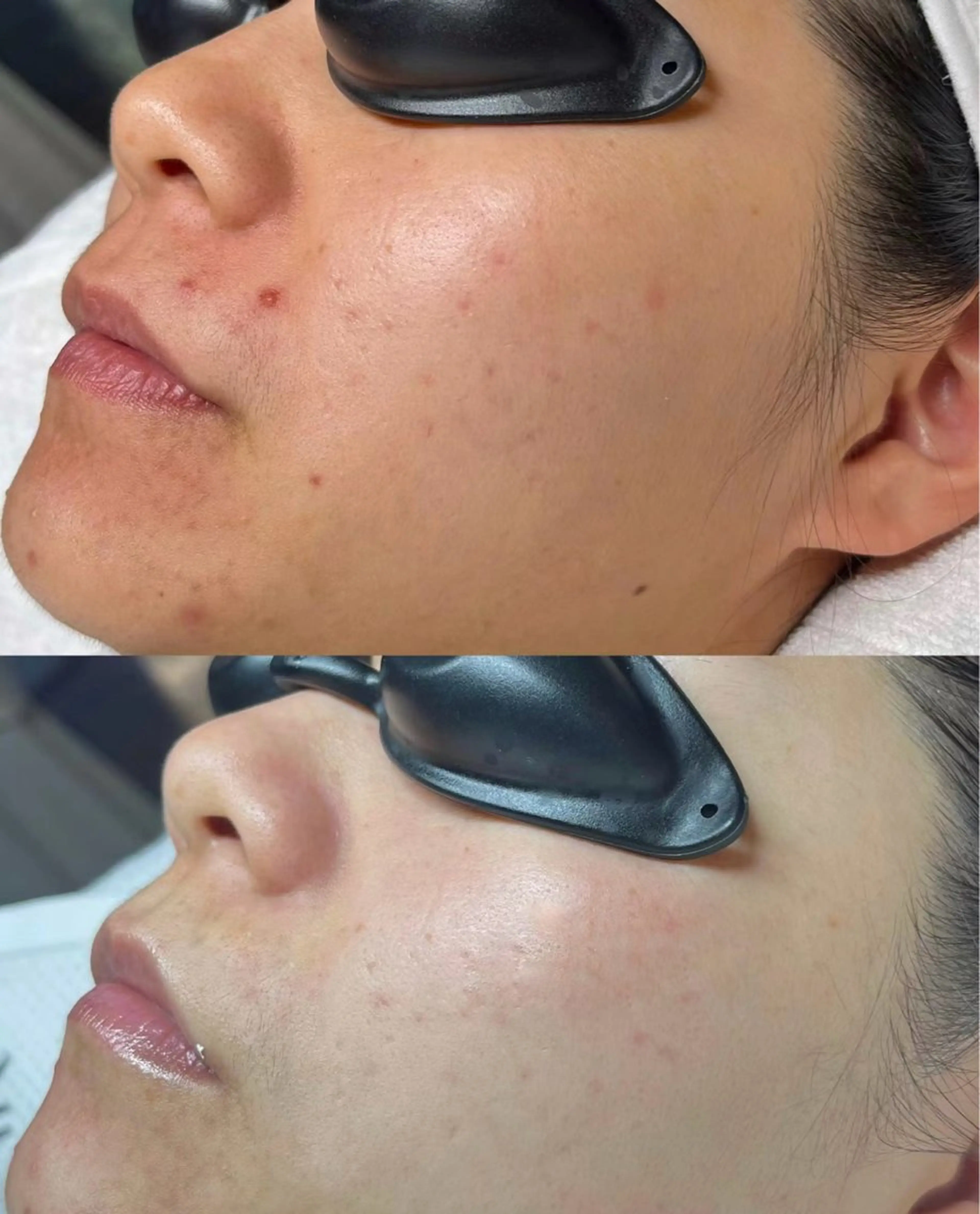 マツエク・マツパ エステ aliaハイフ&水光ジェットサロン所属・aliaハーブ水光店 エステティシャン募集のエステ・リラクイメージ