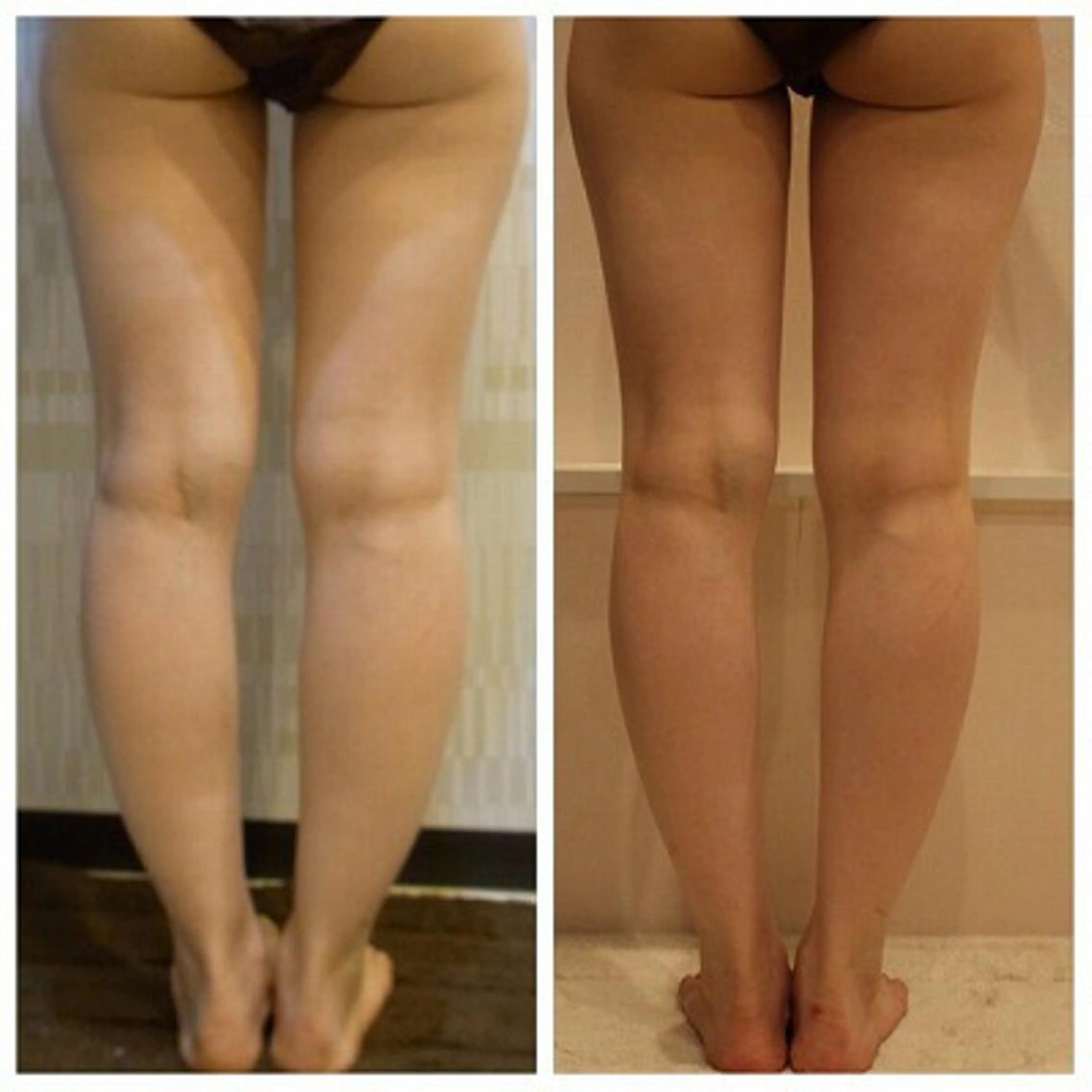 ANRIRE (アンリール)のエステ・リラクイメージ