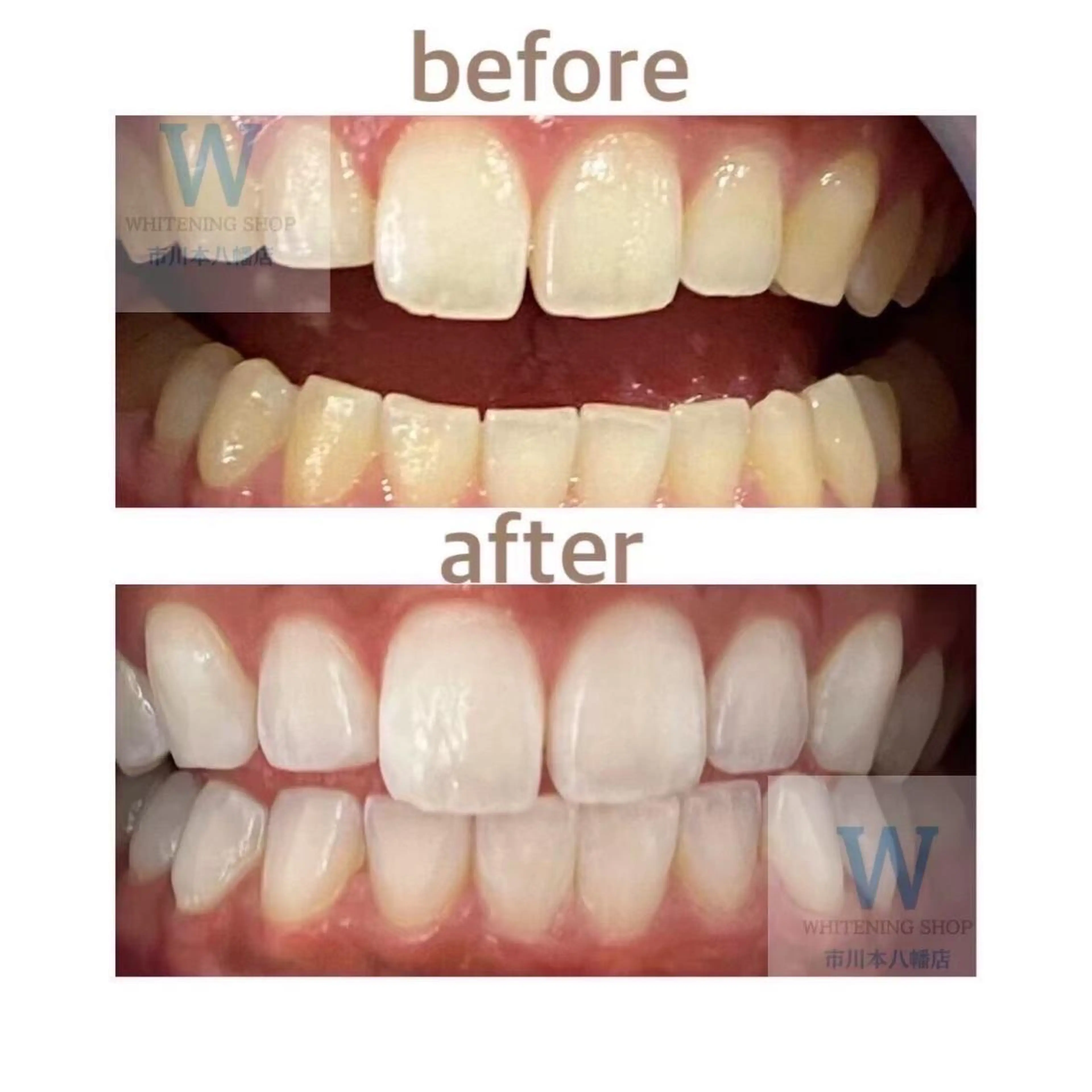 ホワイトニング ショップ本八幡店のエステ・リラクイメージ