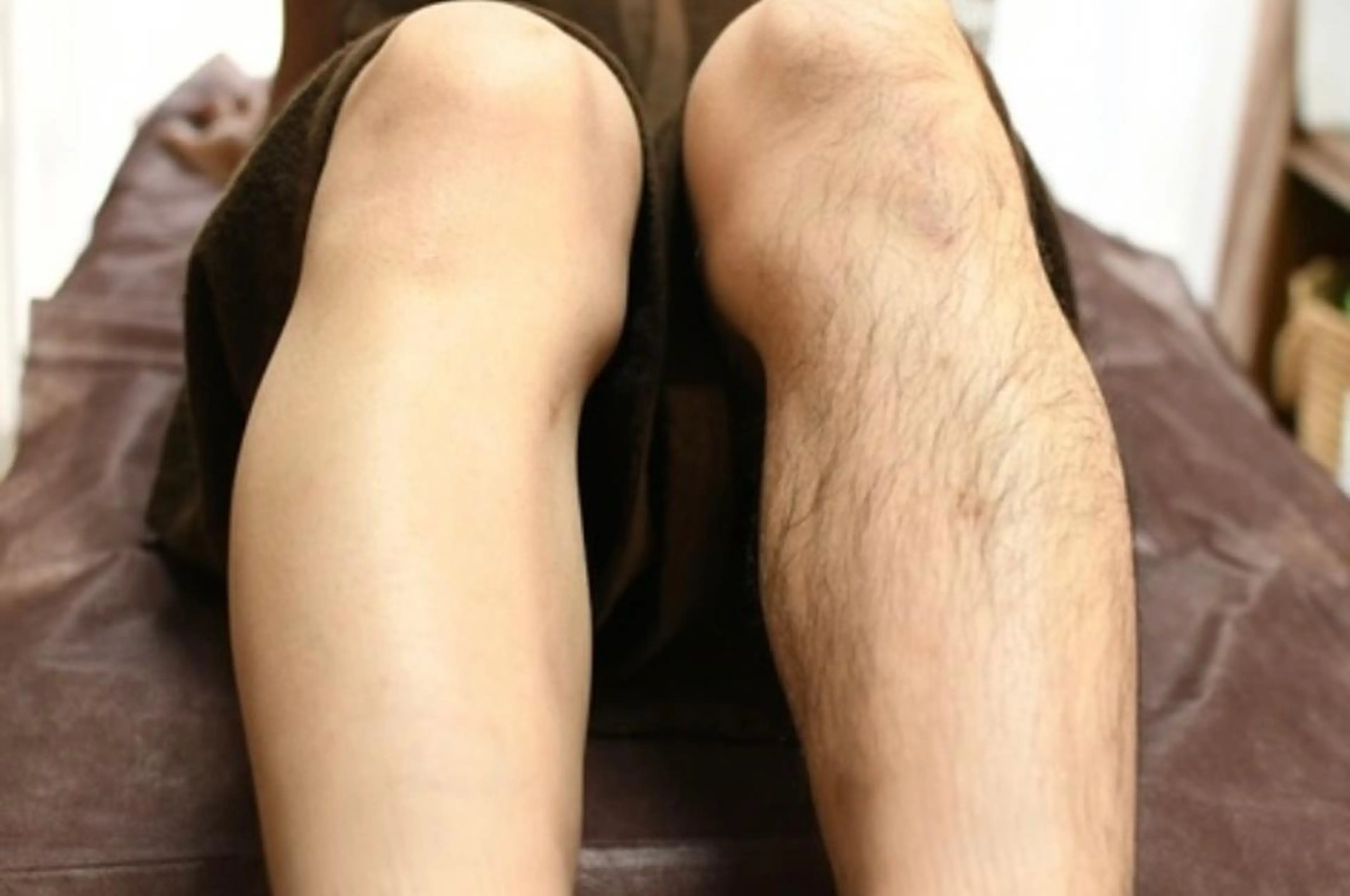 ミニモ限定価格✨ひざ下脱毛の写真