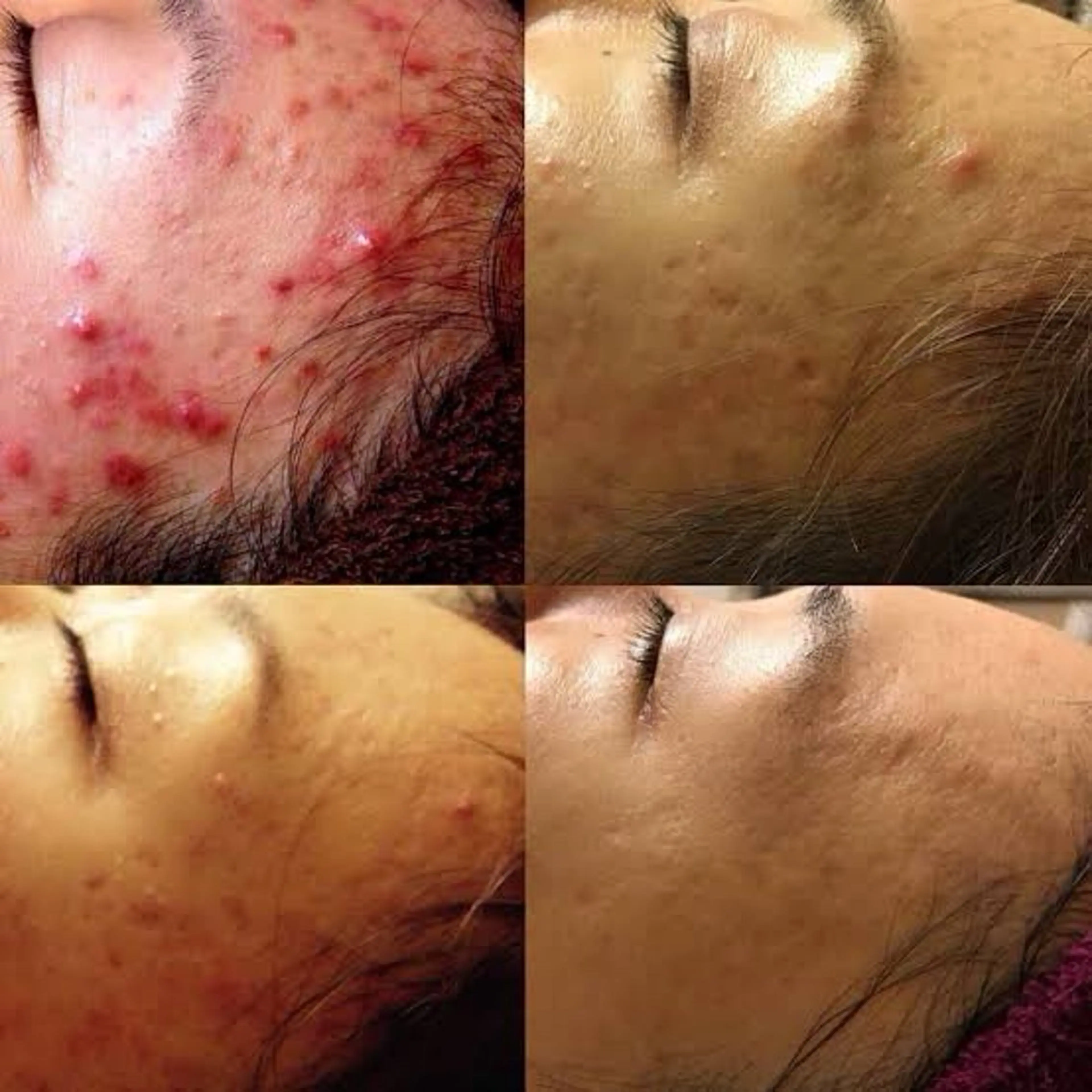 エステ LiZA エステティックサロンのエステ・リラクイメージ